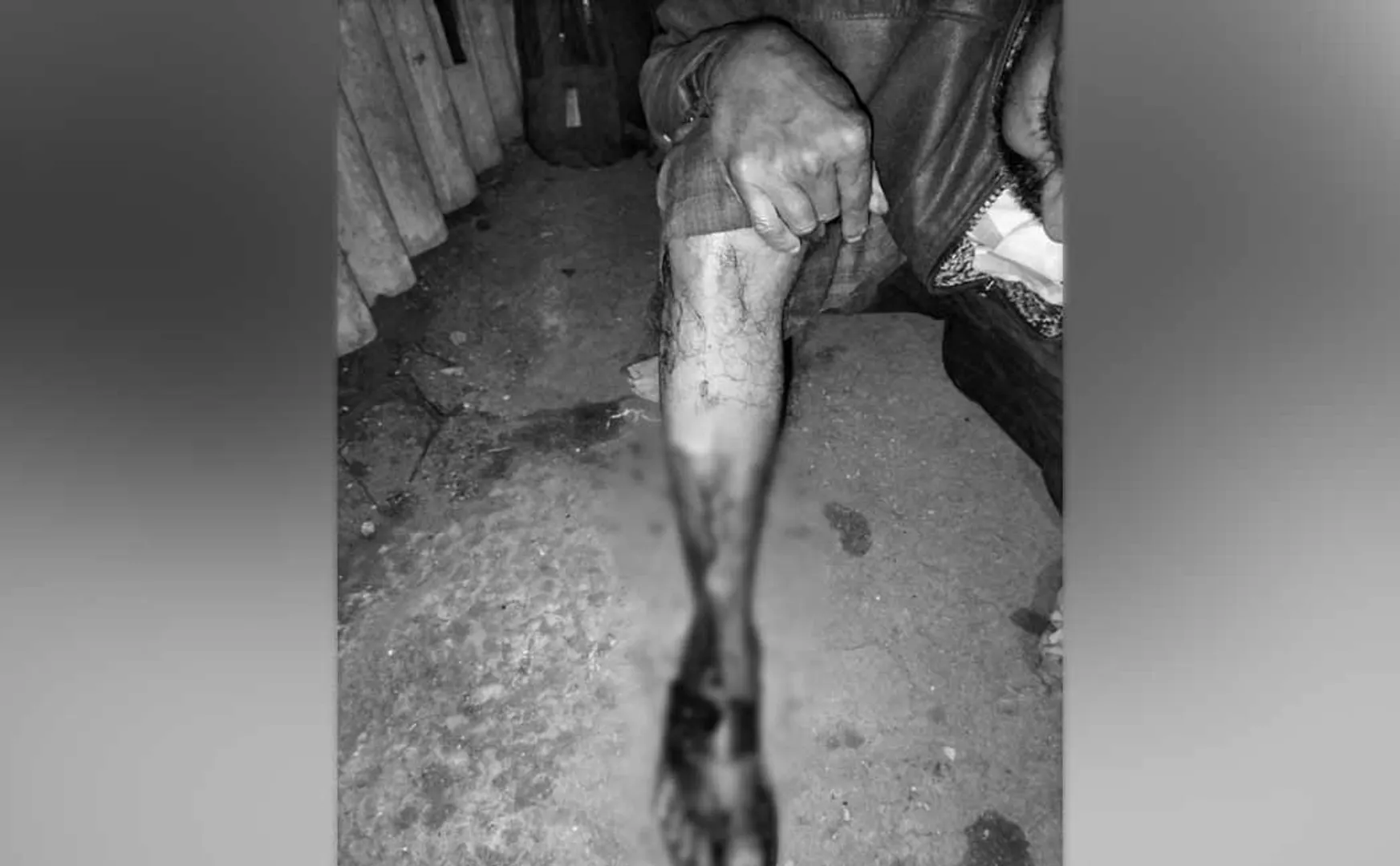 Snake bite and snake catcher passed away