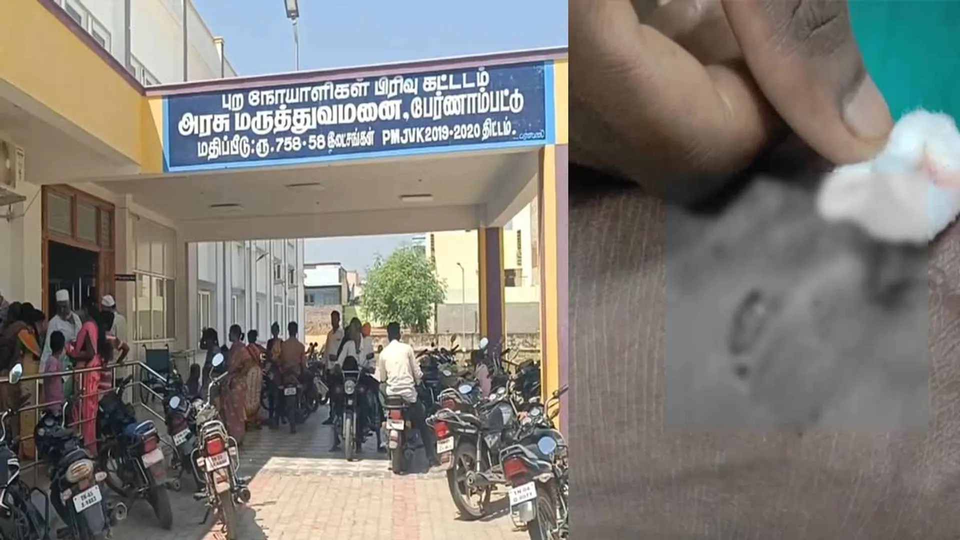  Stray dogs biting; 7 people were injured