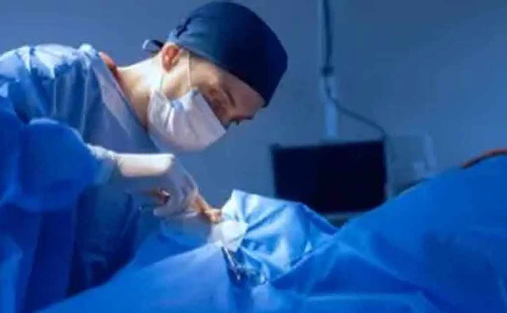 doctors remove 2-kg hair from woman stomach