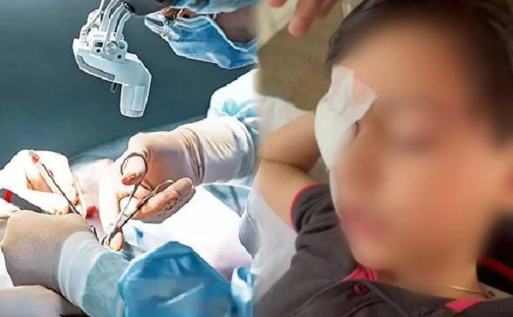 Doctors operated on the right eye instead of the left!