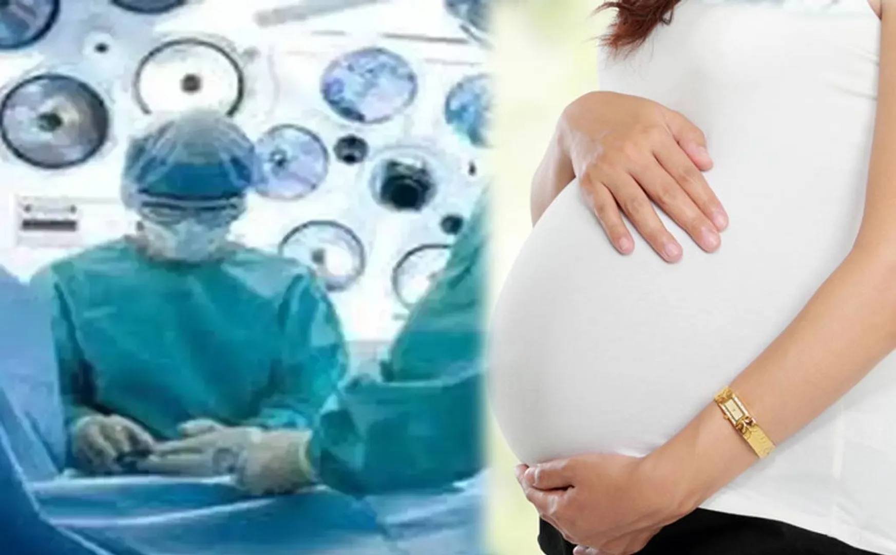 Doctor sewed up woman's stomach with a towel