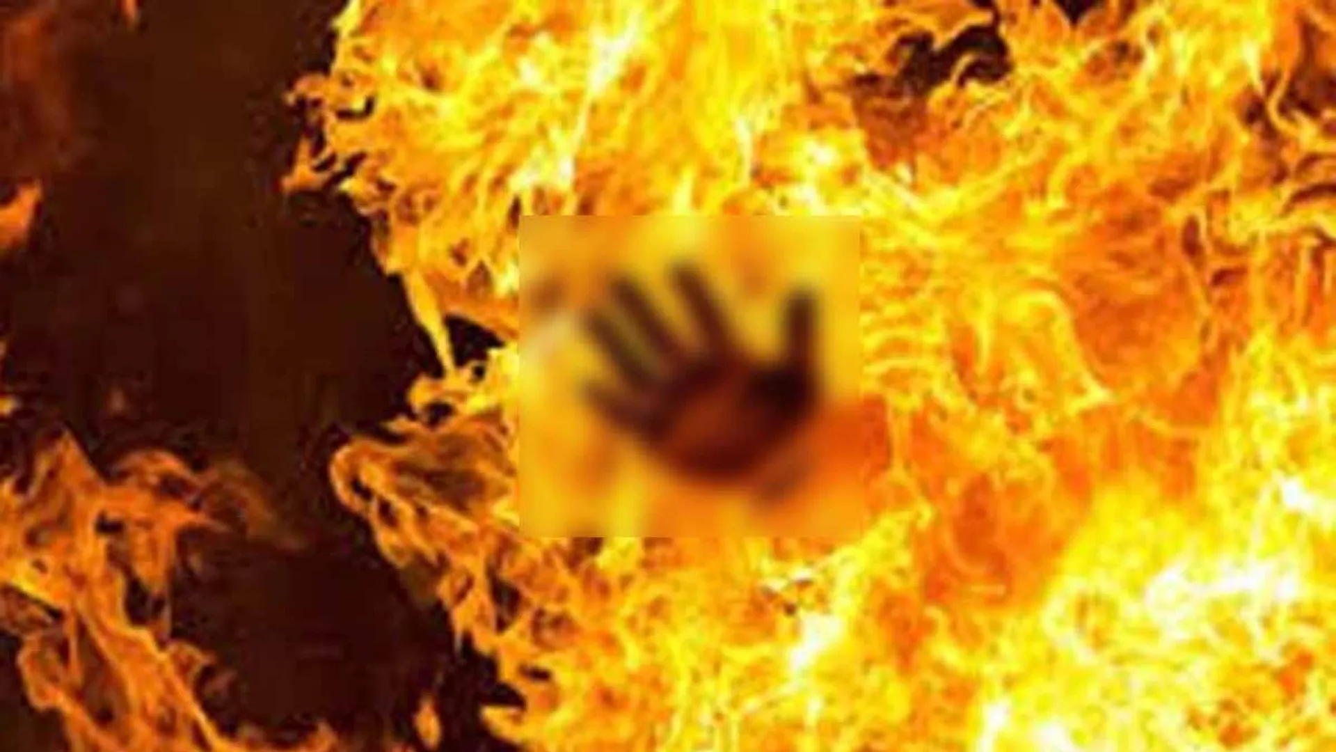 Father pours gasoline on 4-year-old son; Treatment of life-threatening conditions