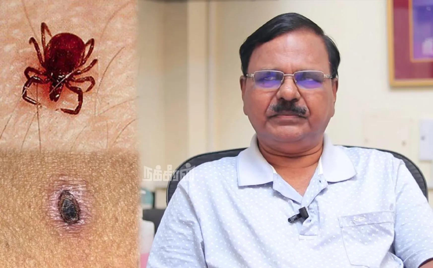 Scrub typhus fever spreading rapidly Dr. Rajendran shares safety awareness