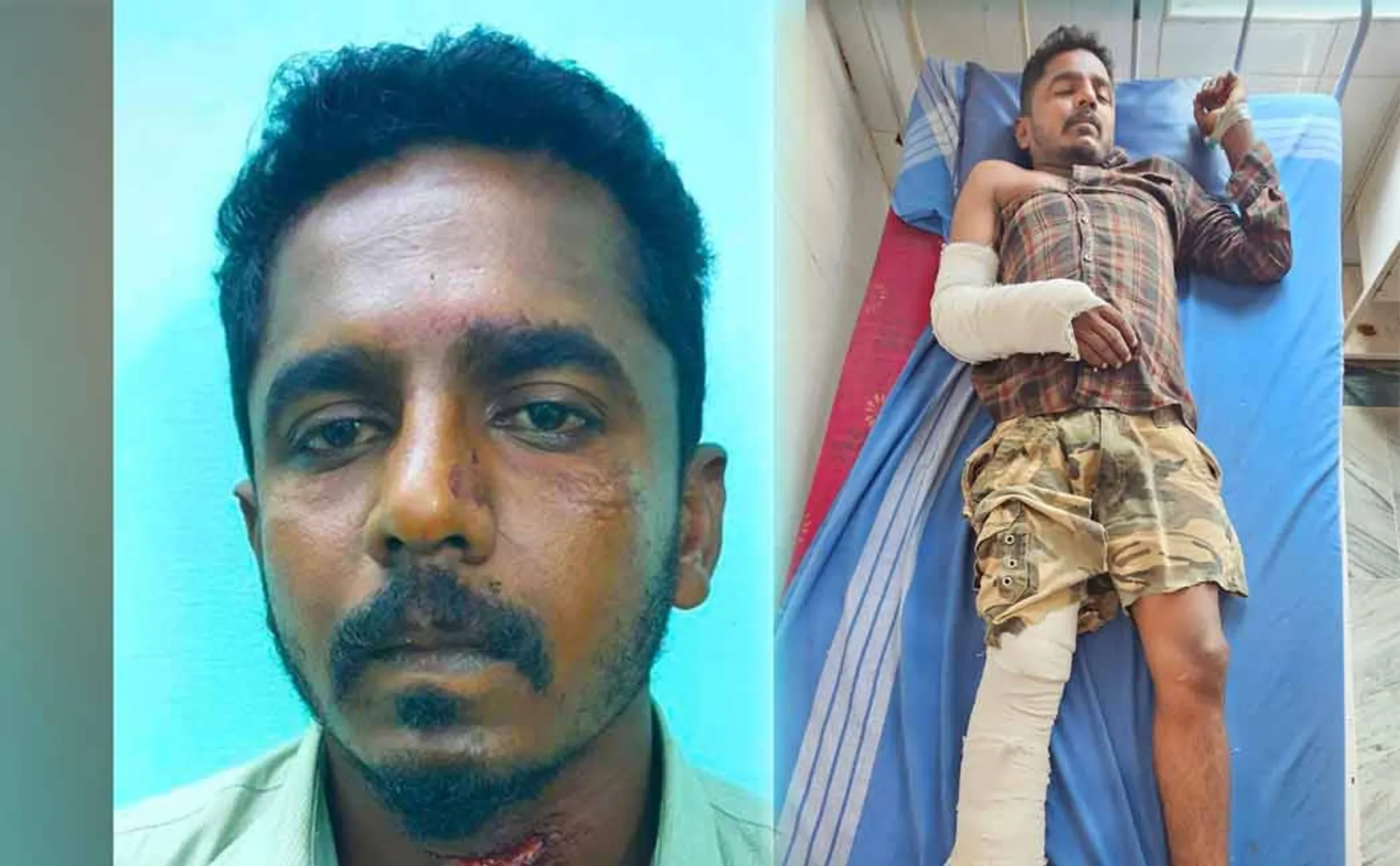 accused in Sipcot police station case has a broken arm and leg