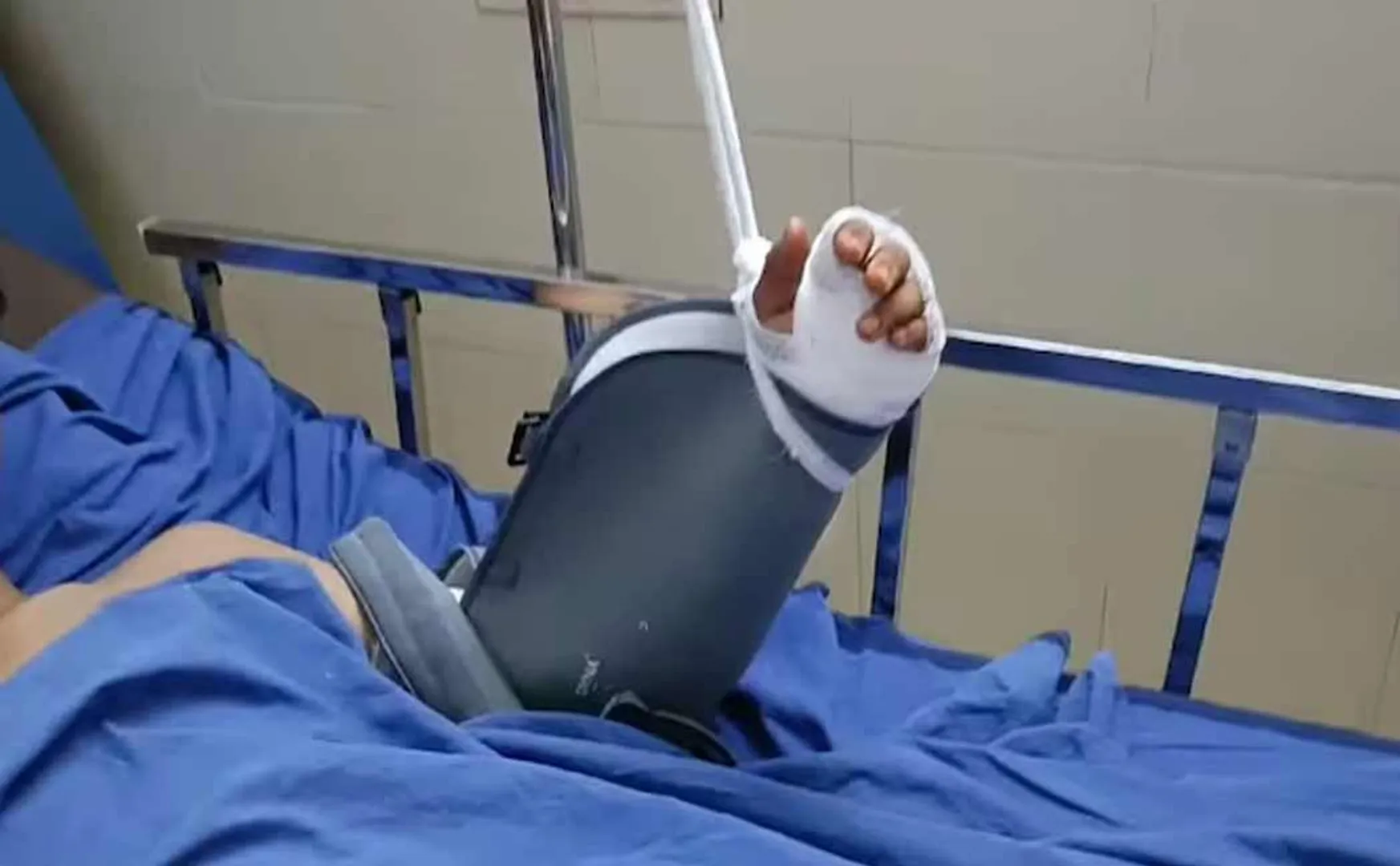 Seniors break the hand of an 11th grade student to ragging atrocity in Kerala