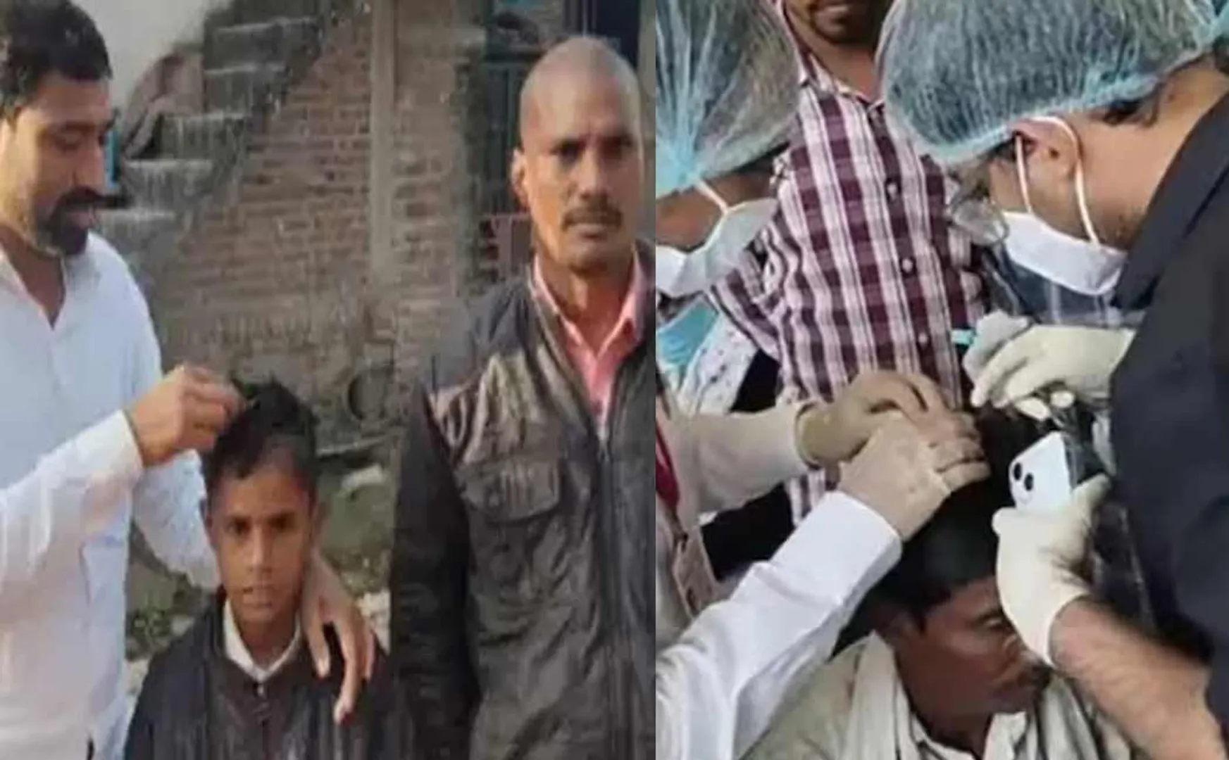 Shocking information in a study released Bald villagers in maharashtra