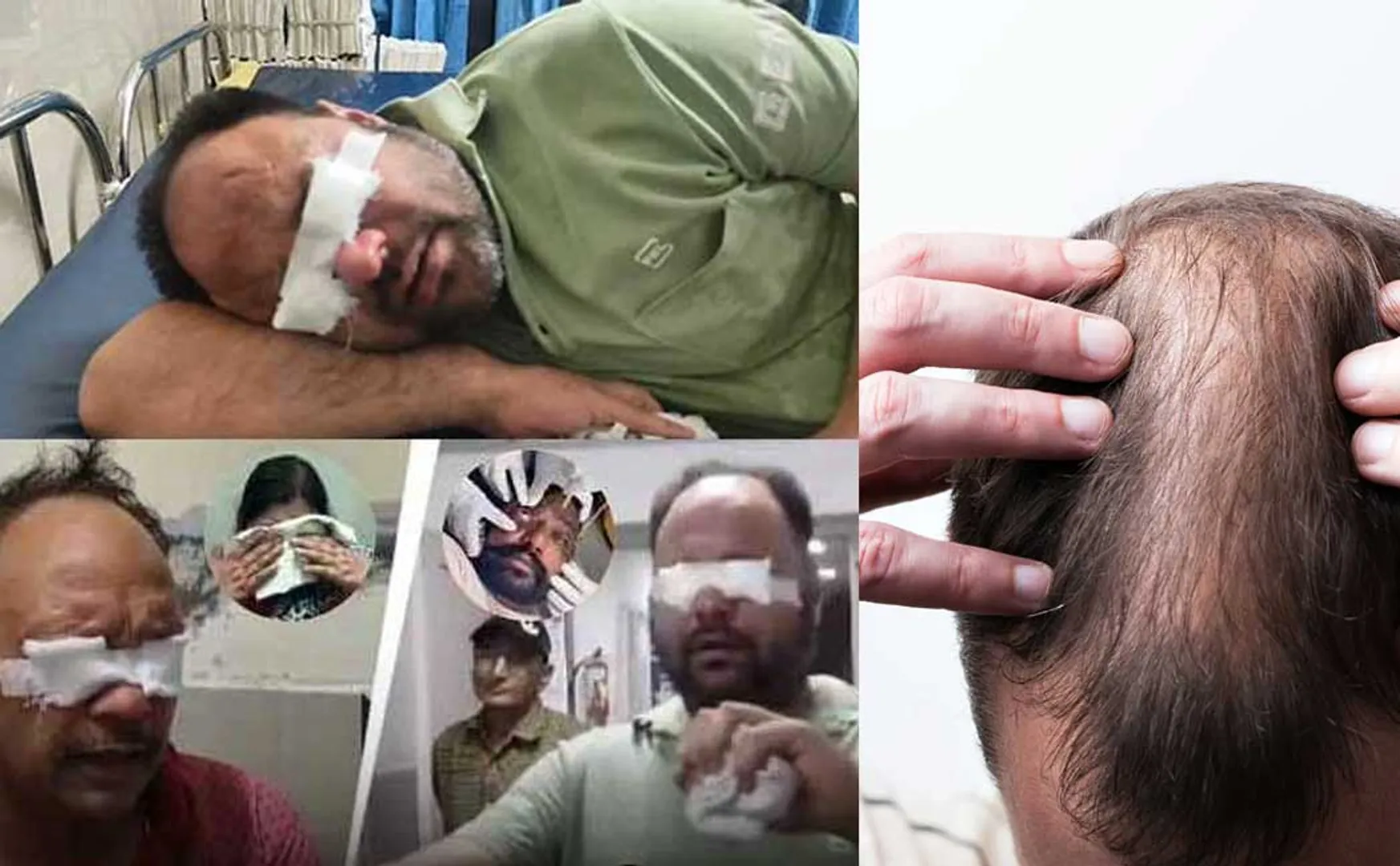 'Hair growth miracle' - The tragedy that befell 65 people who believed in it