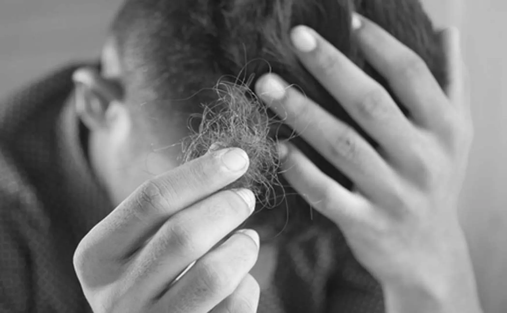 9th student lost their life due to hair fall