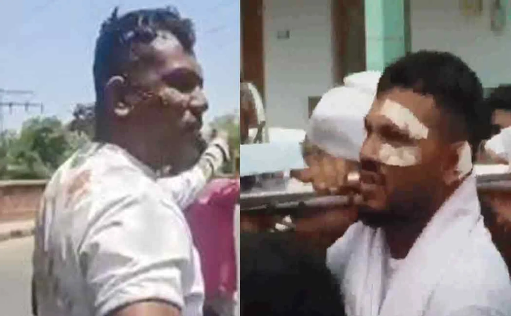 ahmedabad plane crash survivor Vishwas Kumar attended the brother funeral