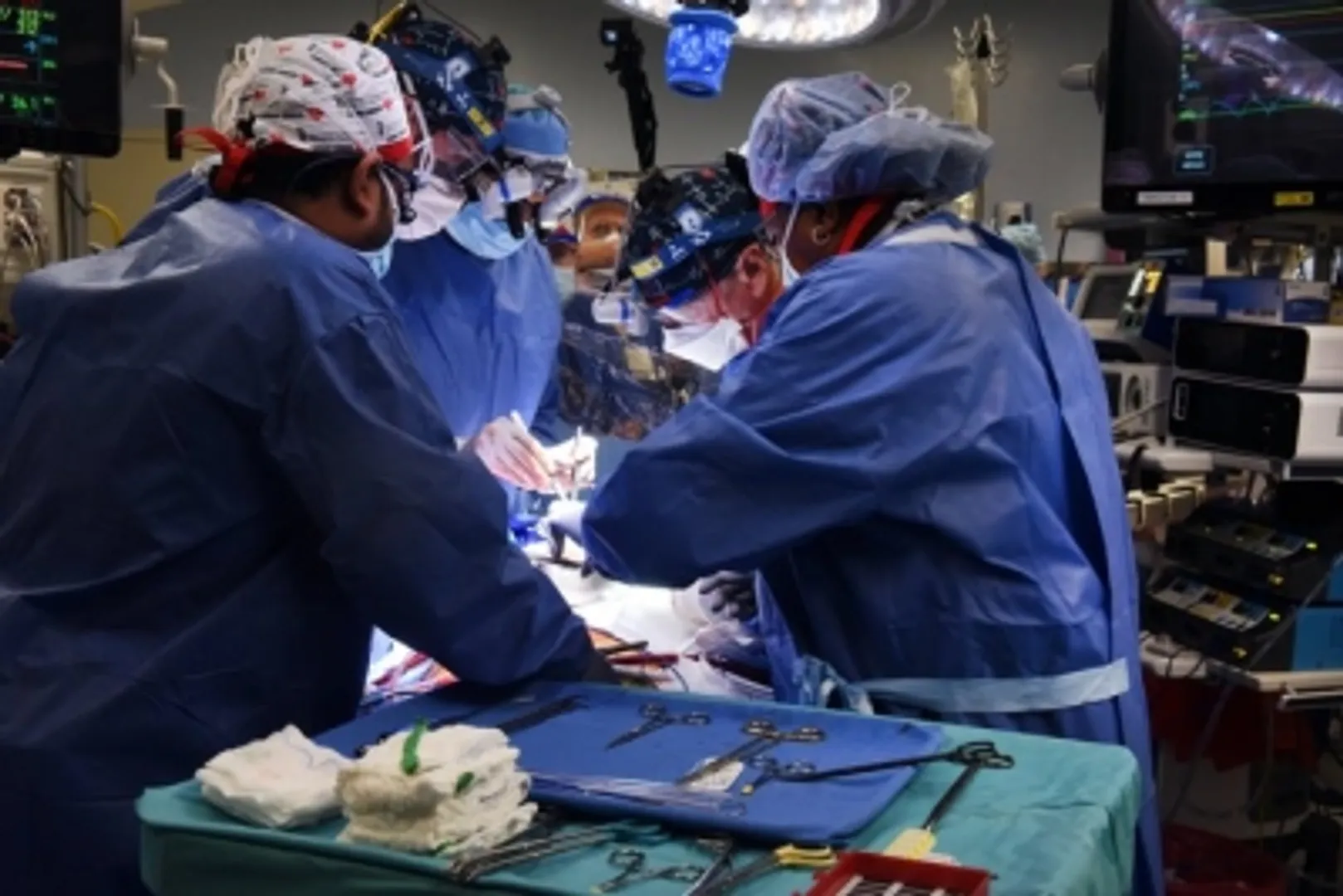 organ transplant pic