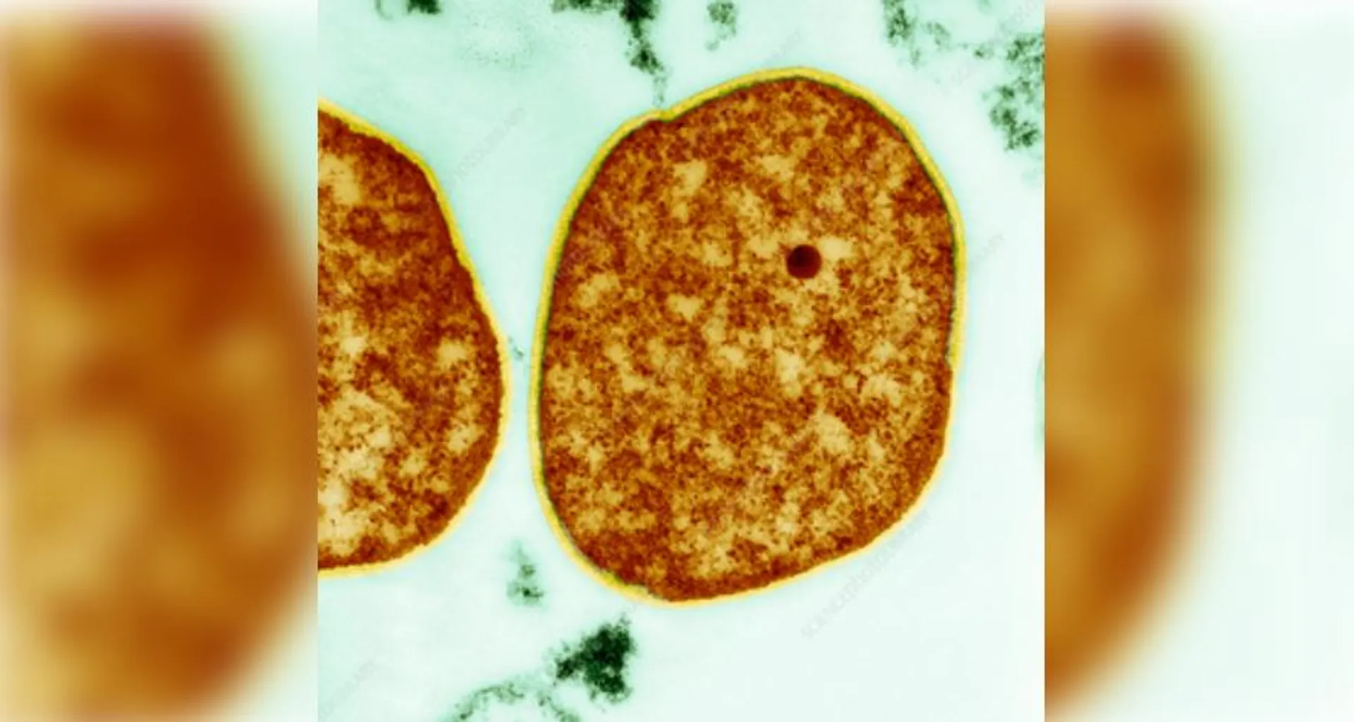 microorganism