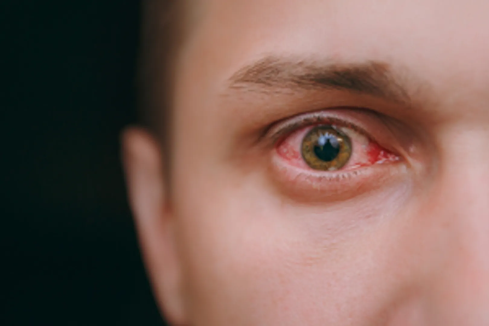human eye 