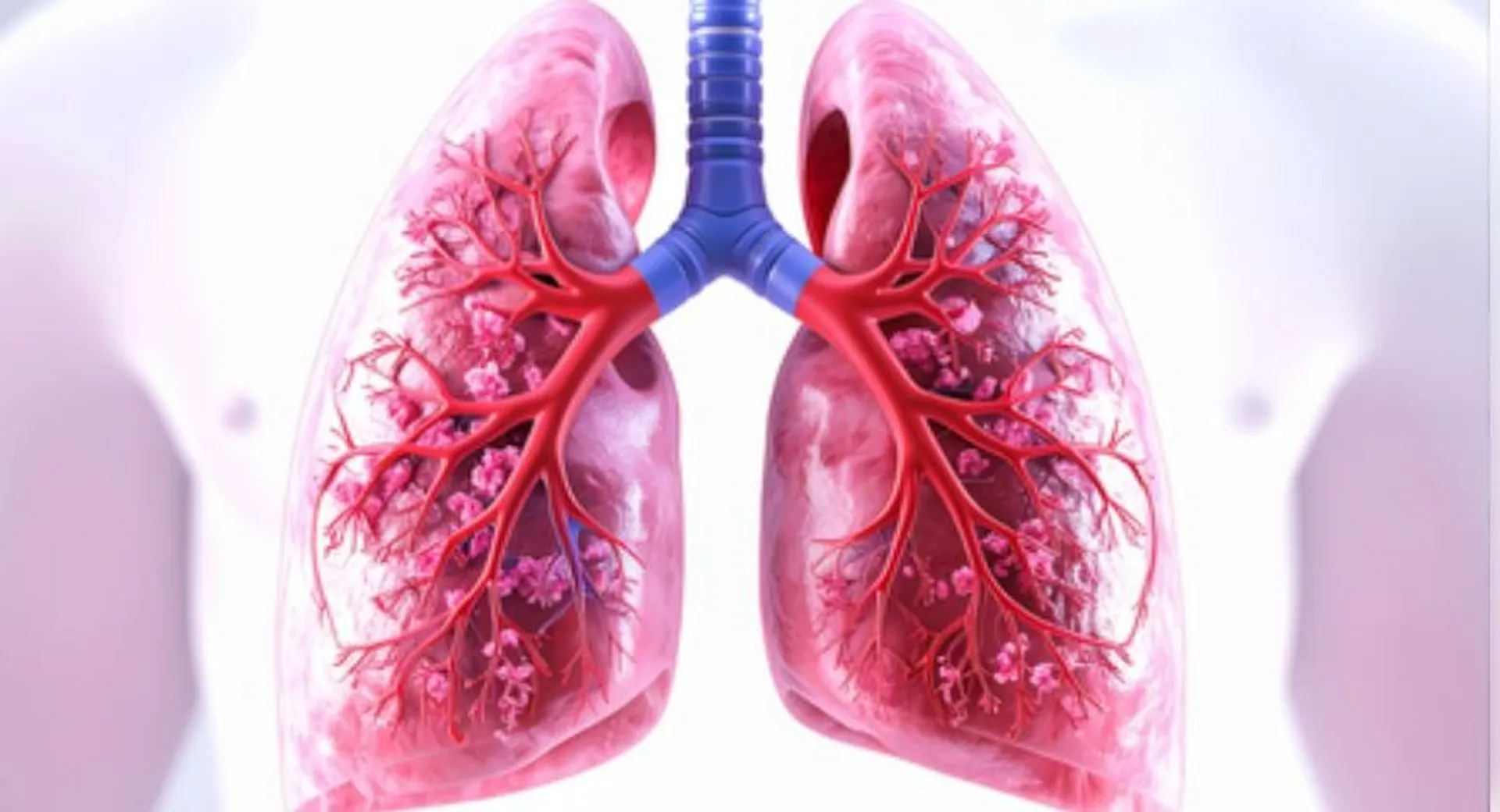 lung