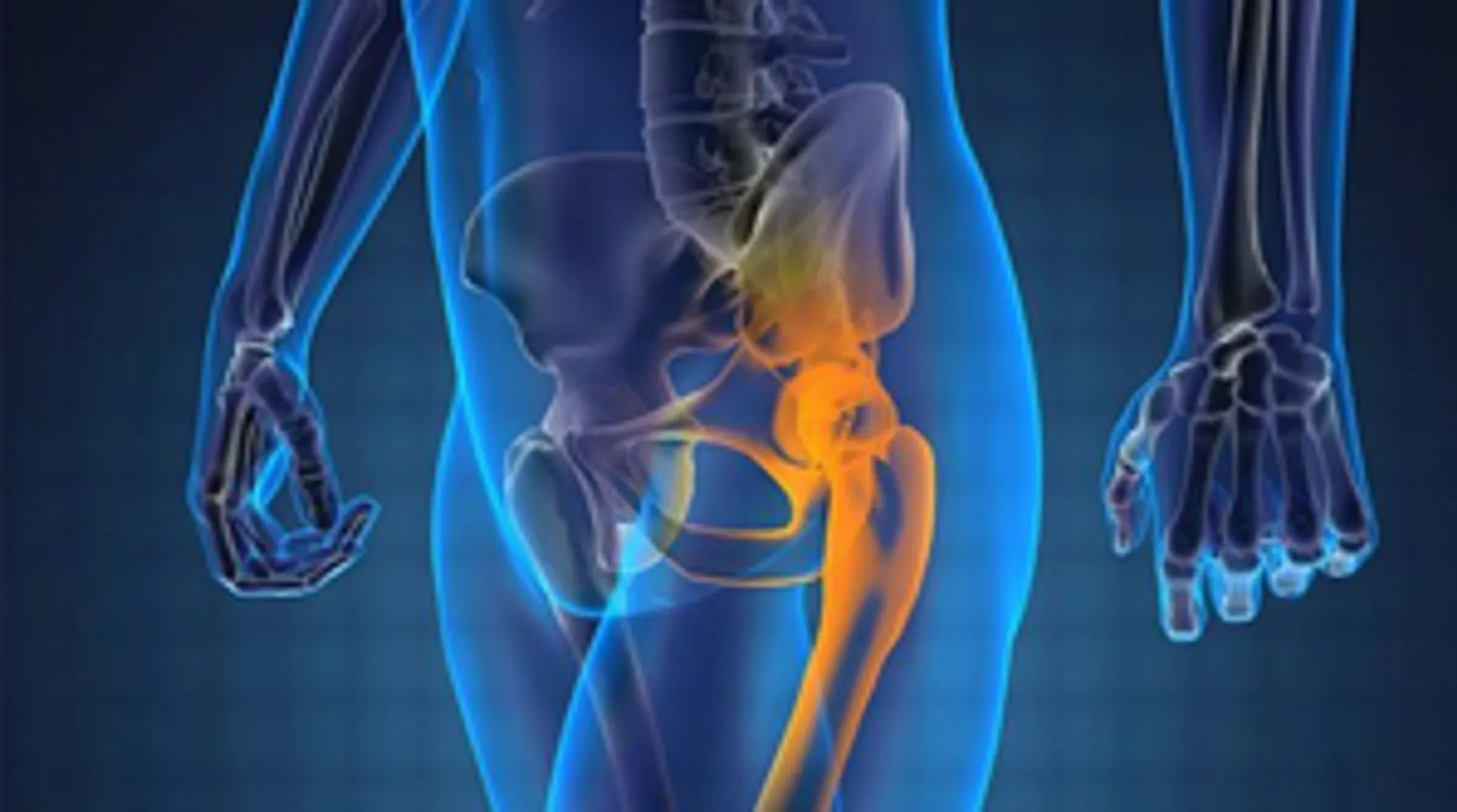 Prostate cancer