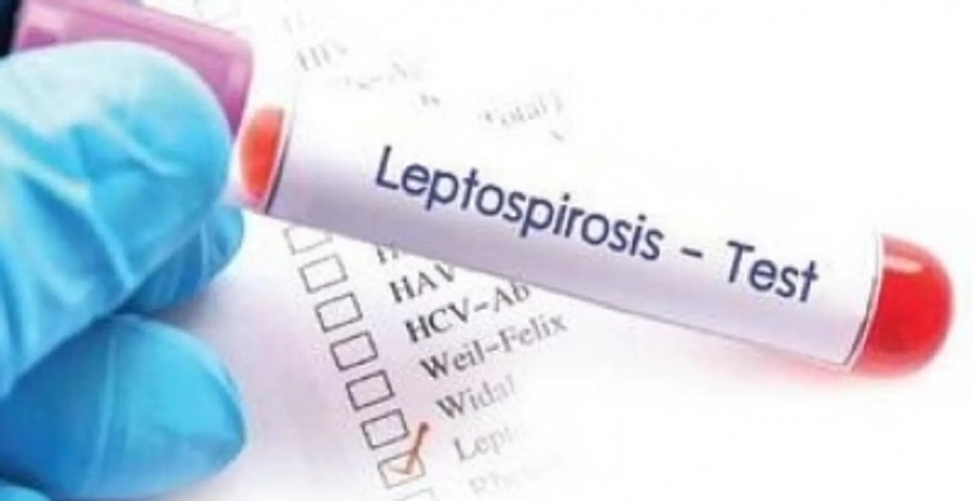 Leptospirosis 