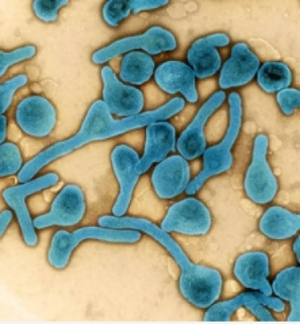 Marburg virus