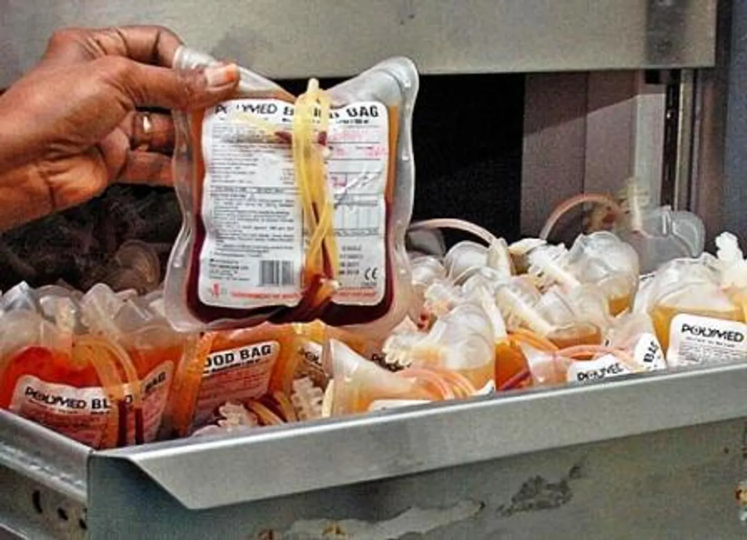 Two more 'blood separation' units in state : CM 
