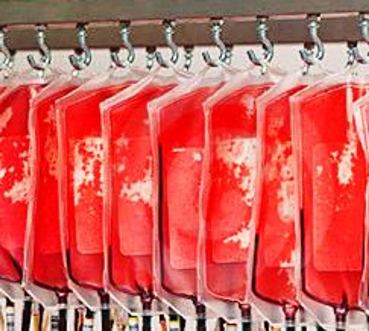 Are blood banks really cash-strapped ?