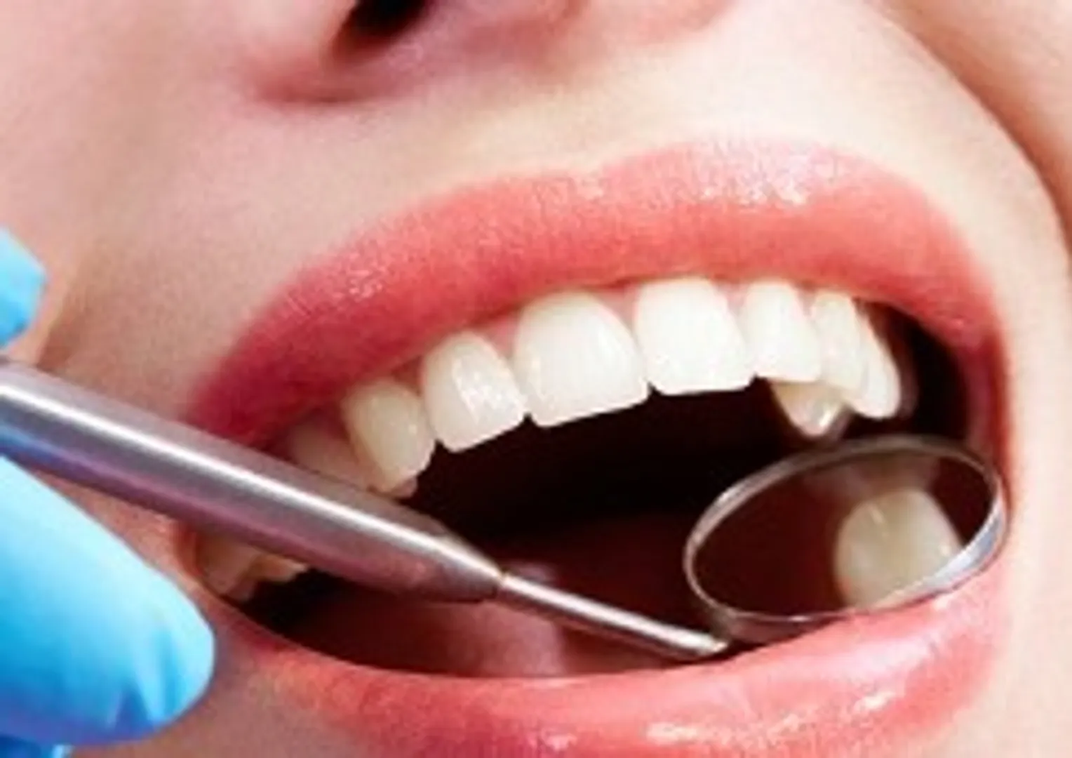 Now, get out of that dentist's chamber fast !
