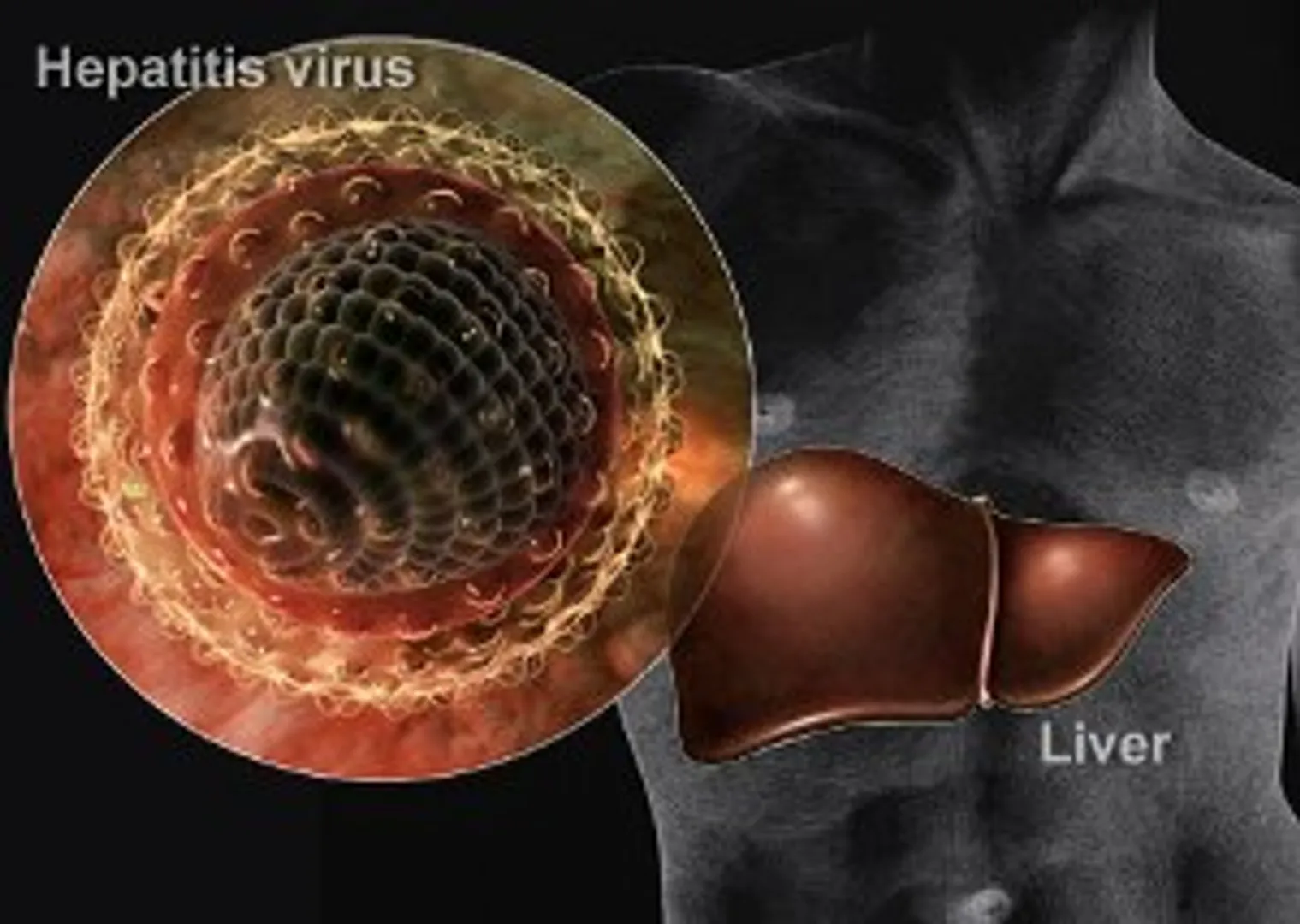 Drinking is deadly for Hepatitis C patients