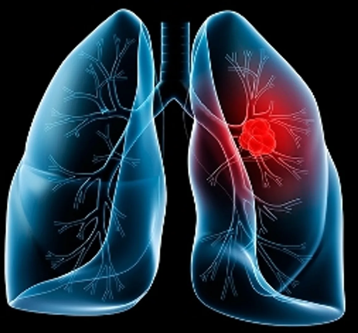 How our lungs respond during asthma attacks