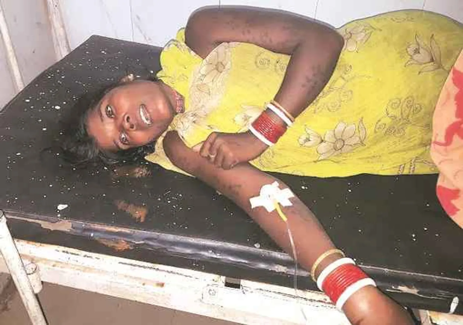 Treated by quack, two siblings die in Odisha's Nabarangpur