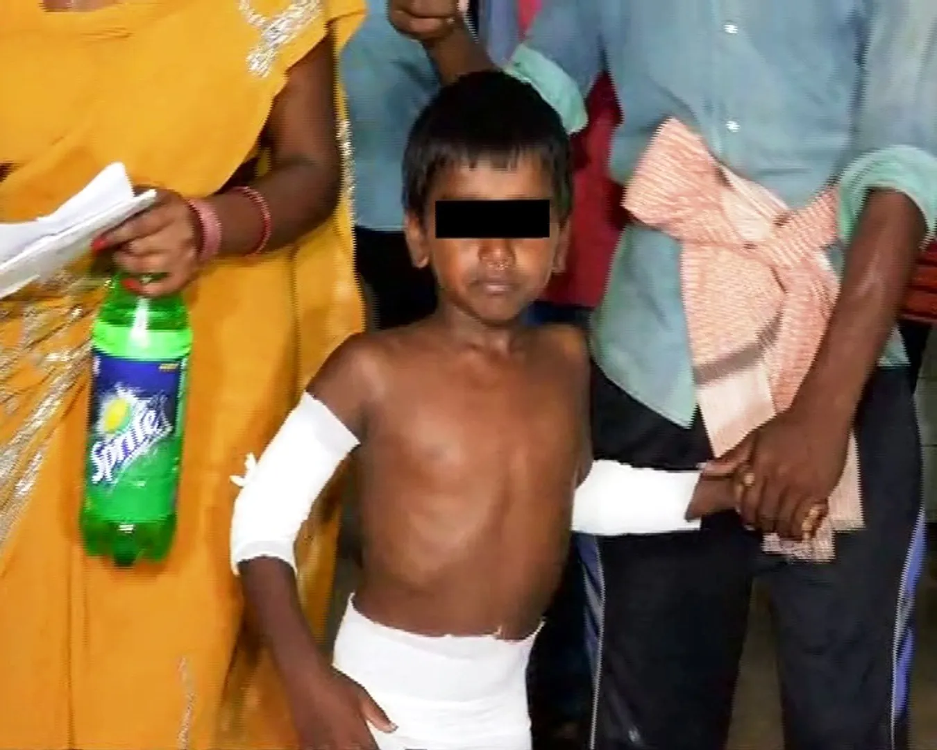 Odisha man brands 5-year-old son with hot iron for being disobedient