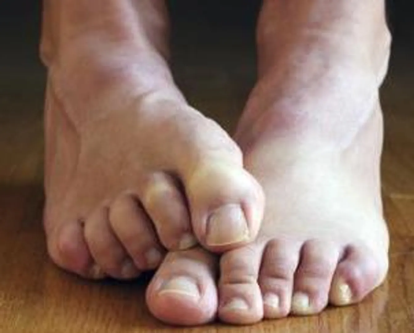 Know how to cure smelly feet, sunburns at home