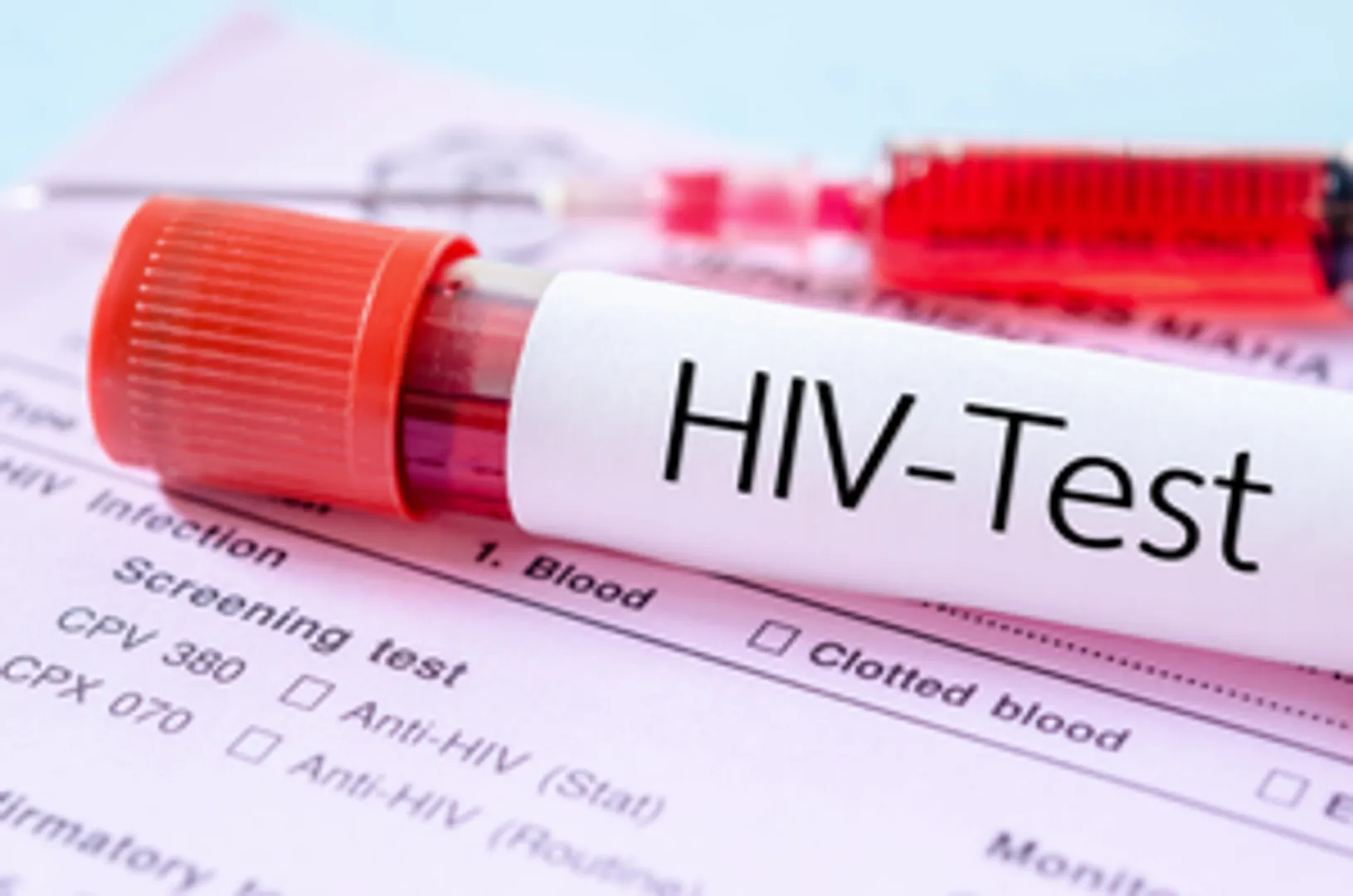 Experimental cancer drug may help clear HIV from brain cells