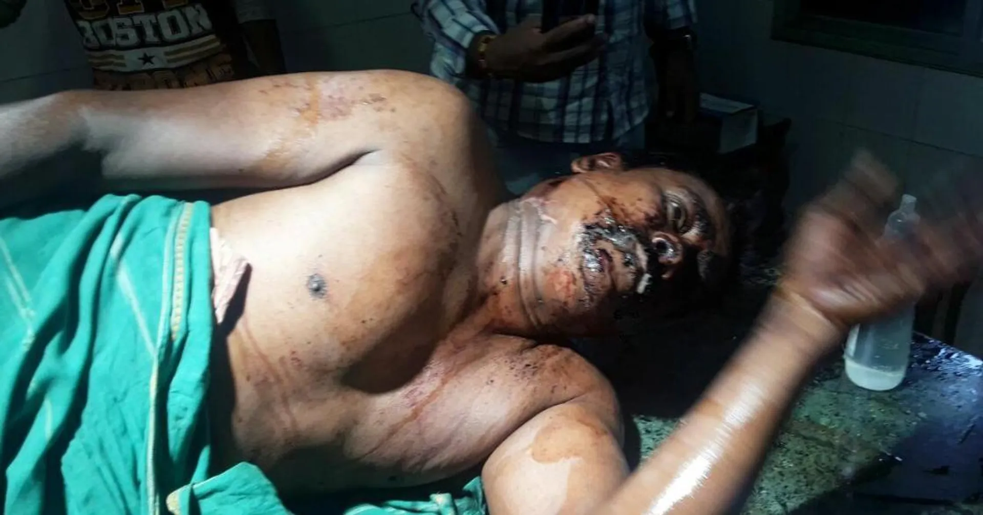 ଭୁବନେଶ୍ୱର: ଯୁବକଙ୍କୁ ମାରଣାତ୍ମକ ଆକ୍ରମଣ
