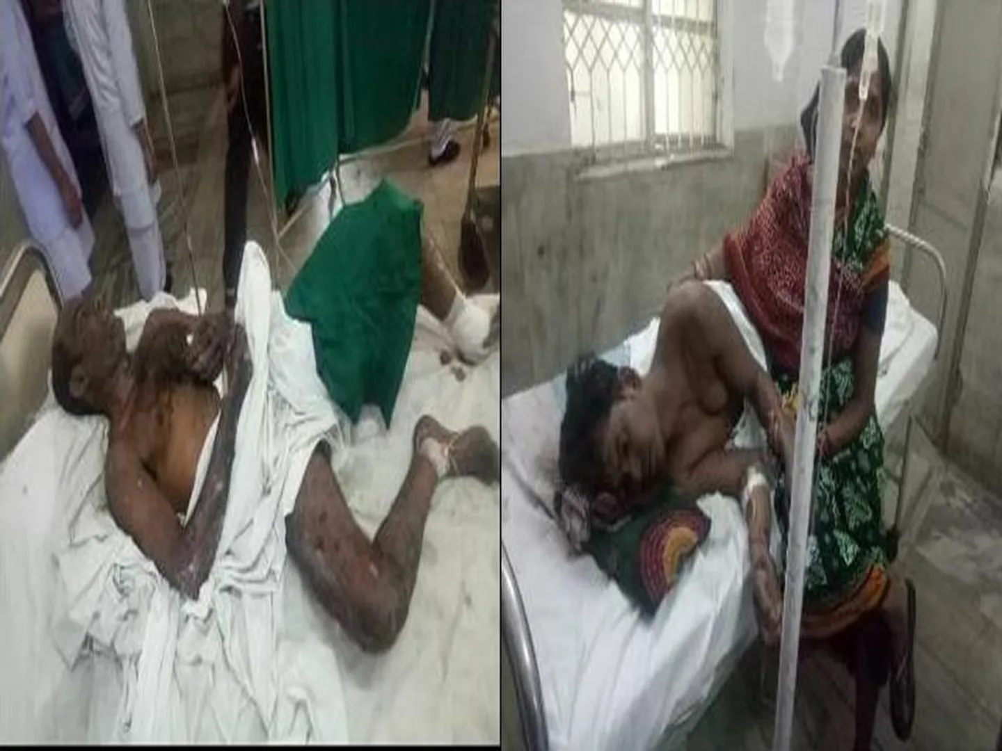 ବ୍ରଜରାଜନଗର: କୋଇଲା ଖଣିରେ ଦୁର୍ଘଟଣା, ୨ଗୁରୁତର