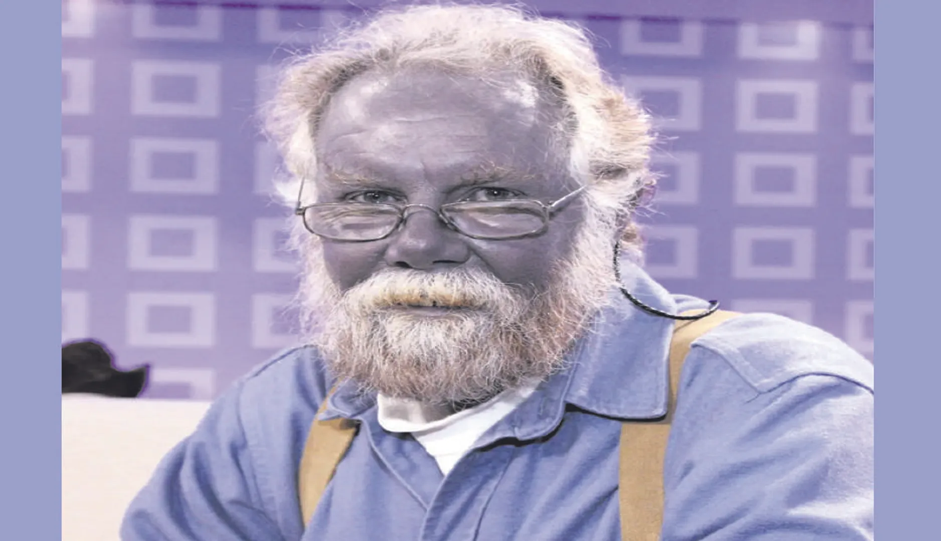 ନୀଳ ମଣିଷ କାରାସନ୍: ଏହି କାରଣରୁ ଦେହର ରଙ୍ଗ ଧଳାରୁ ପାଲଟିଯାଇଥିଲା ନୀଳ