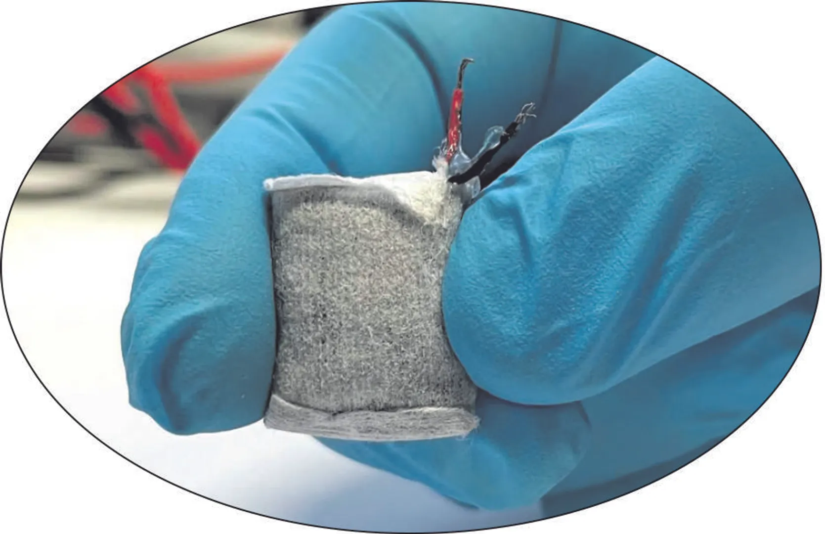 ଟାଇପ୍‌-୧ ମଧୁମେହ କମାଇବ ବାୟୋଟେକ୍‌ ବ୍ୟାଟେରି