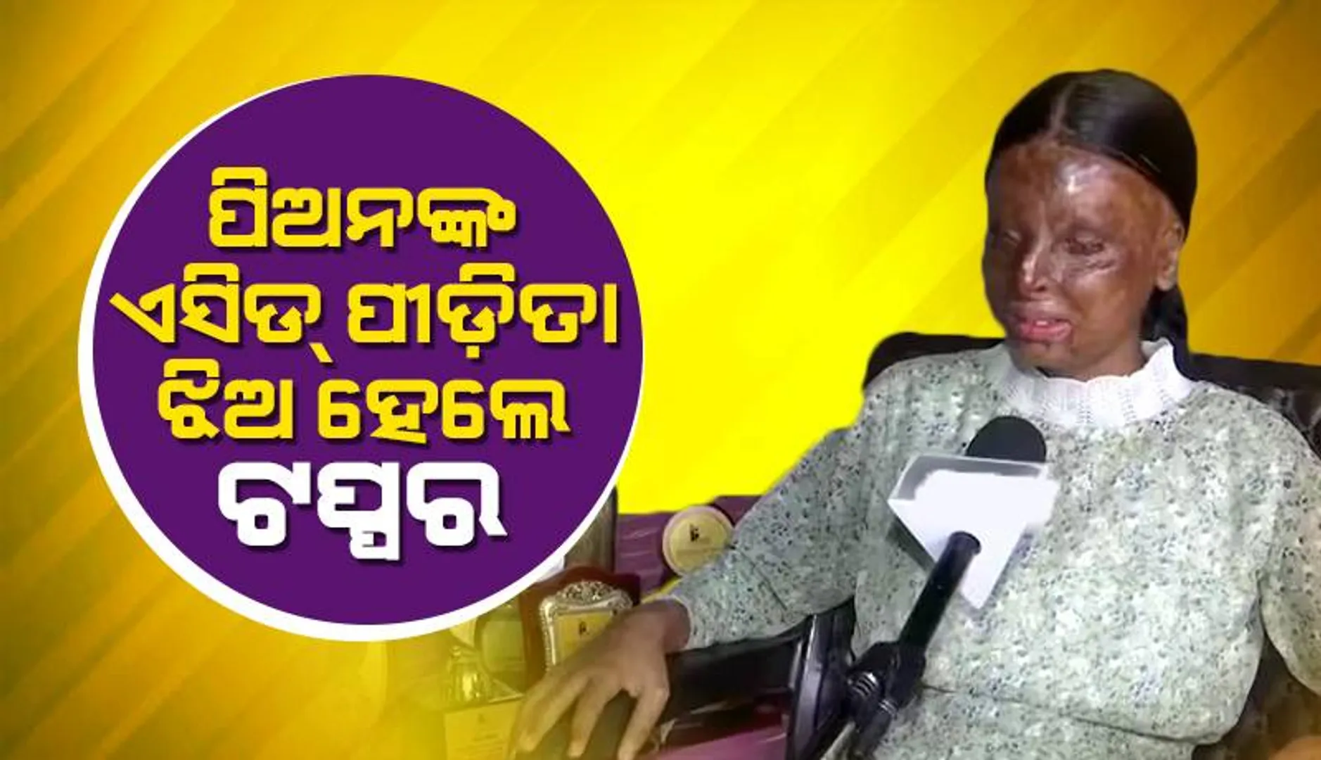 ପଡ଼ିଶାଙ୍କ ଏସିଡ଼ ଆକ୍ରମଣର ଶିକାର ହୋଇ ତିନିବର୍ଷ ବୟସରେ ଦୃଷ୍ଟିଶକ୍ତି ହରାଇଥିବା ପୀଡ଼ିତା ହେଲେ ଟପ୍ପର