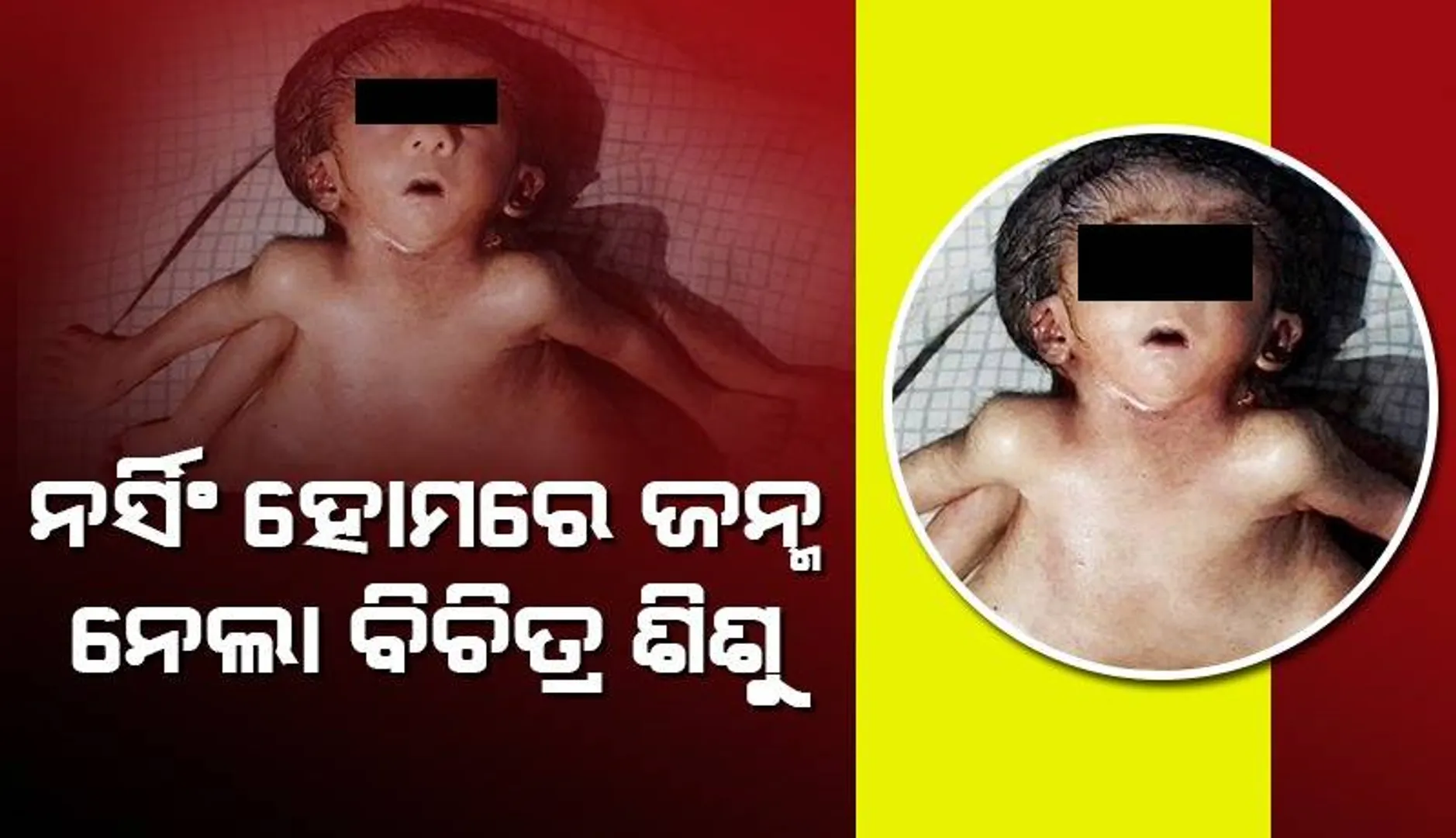 ପ୍ରଥମ ଥର ପାଇଁ ଗର୍ଭବତୀ ହୋଇ ୪ଟି ହାତ,୪ଟି ଗୋଡ଼ ଓ ଦୁଇଟି ହୃଦୟ ଥିବା ଶିଶକୁ ଜନ୍ମ ଦେଲେ ମହିଳା
