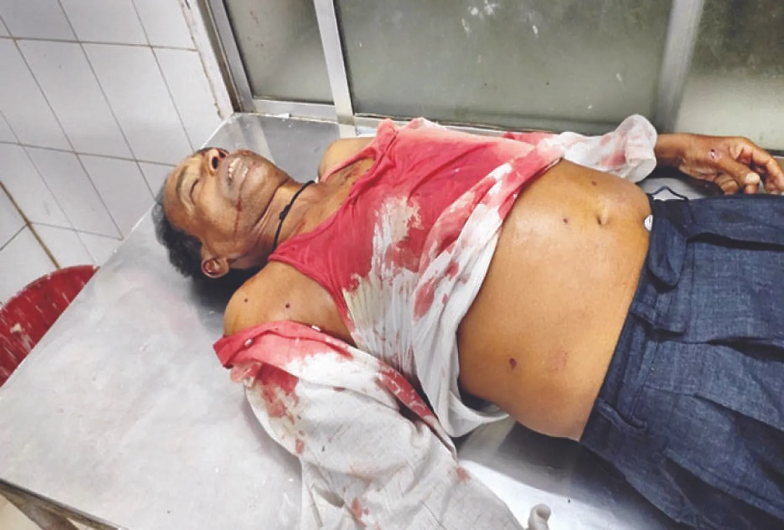 ଗୁଳିମାଡ଼ରେ ବାପା ମୃତ, ଝିଅ ଆହତ