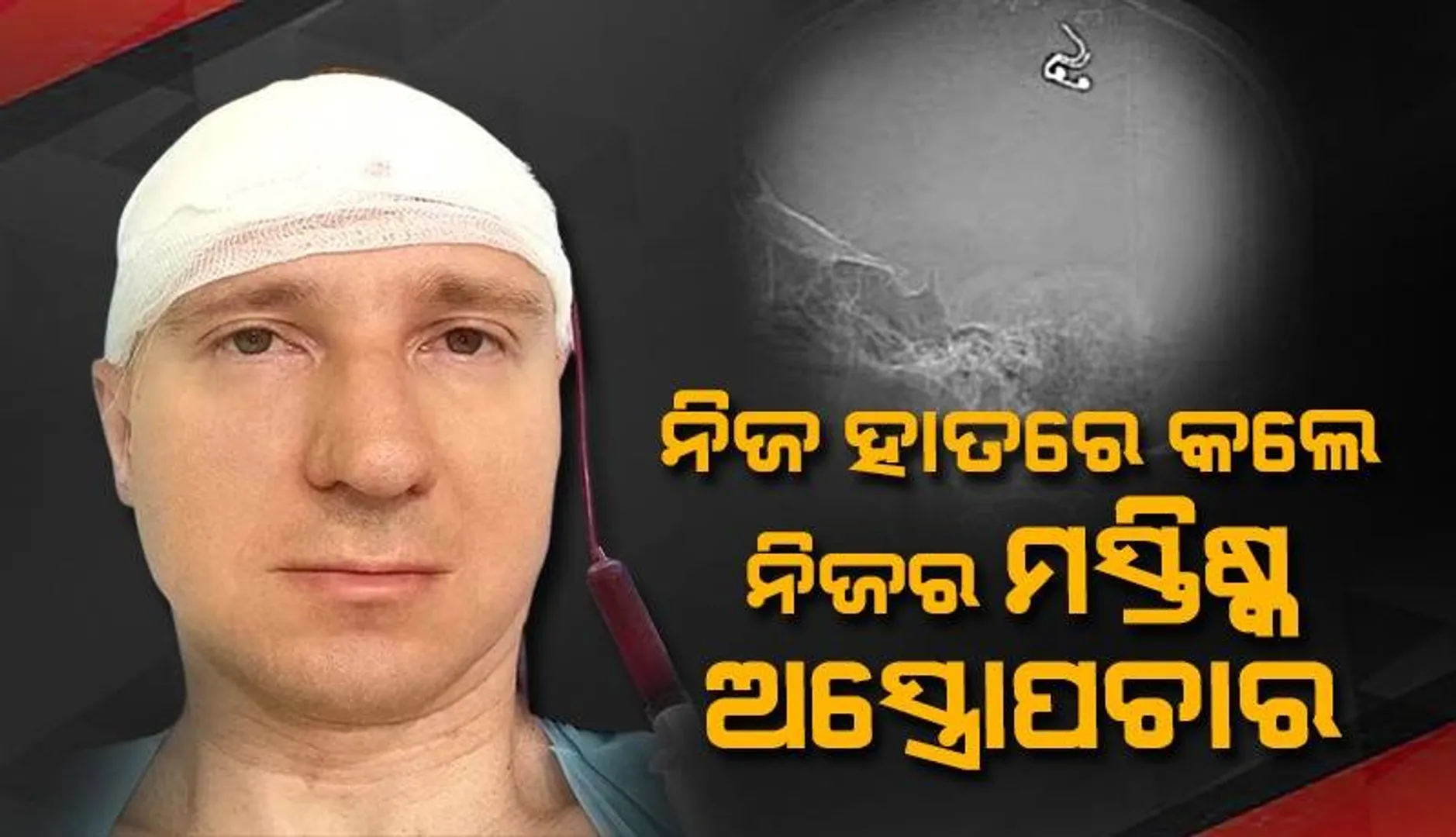 ସ୍ବପ୍ନକୁ ନିୟନ୍ତ୍ରଣ କରିବାକୁ ମୁଣ୍ଡରେ ଇଲୋକ୍ଟ୍ରଡ୍‌ ଖଞ୍ଜିଲେ ବୈଜ୍ଞାନିକ; କହିଲେ ମୁଁ ଖୁସି ଯେ ବଞ୍ଚିଛି, ମରିବାକୁ ପ୍ରସ୍ତୁତ ଥିଲି