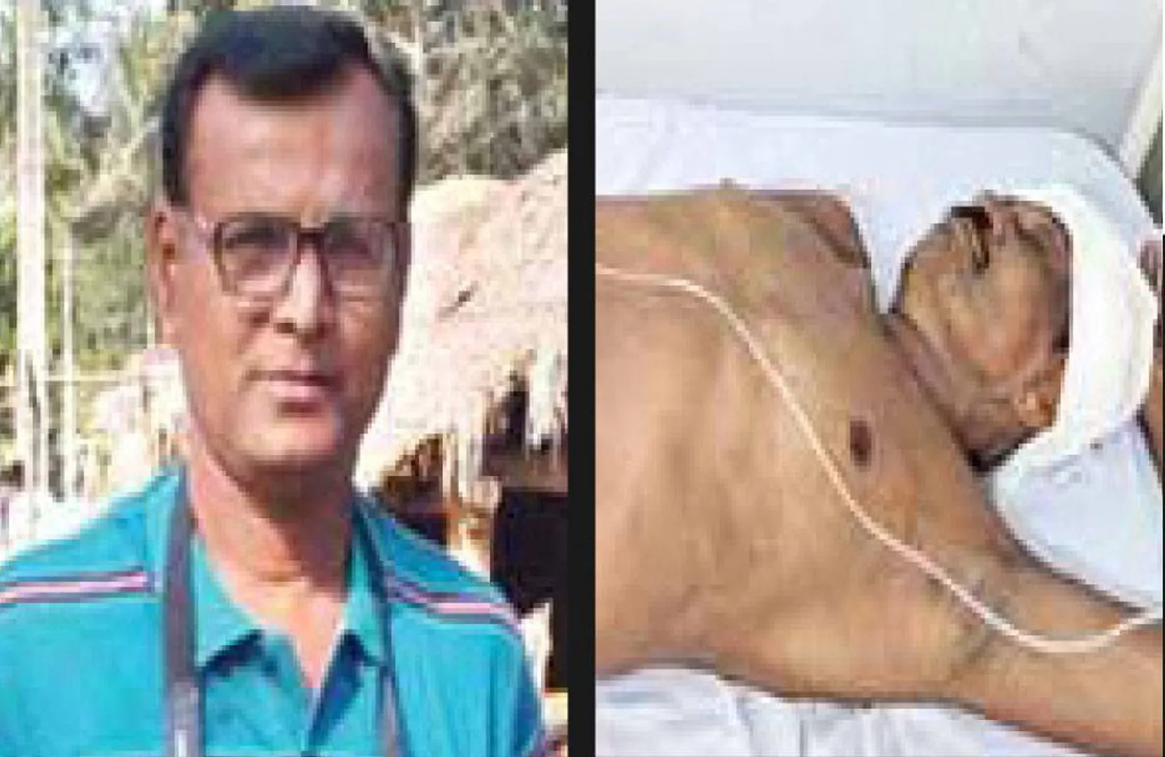 ବିଦ୍ୟୁତ୍ ବିଲ୍ ଅଧିକ ହେବାରୁ ମିଟର୍ ରିଡର୍‌ଙ୍କୁ ହତ୍ୟା: ହତ୍ୟାକାରୀକୁ ଧରିବାକୁ ଯାଇ ଆକ୍ରମଣରେ ଜଣେ ଆହତ