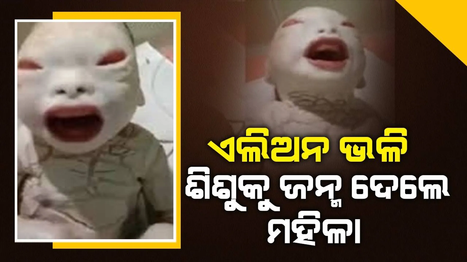 ‘ହେ ଭଗବାନ ମୁଁ କି ଦୋଷ କରିଥିଲି, ମୋ ନବଜାତକୁ ଏମିତି କାହିଁକି ଗଢ଼ିଲ’: ମା’