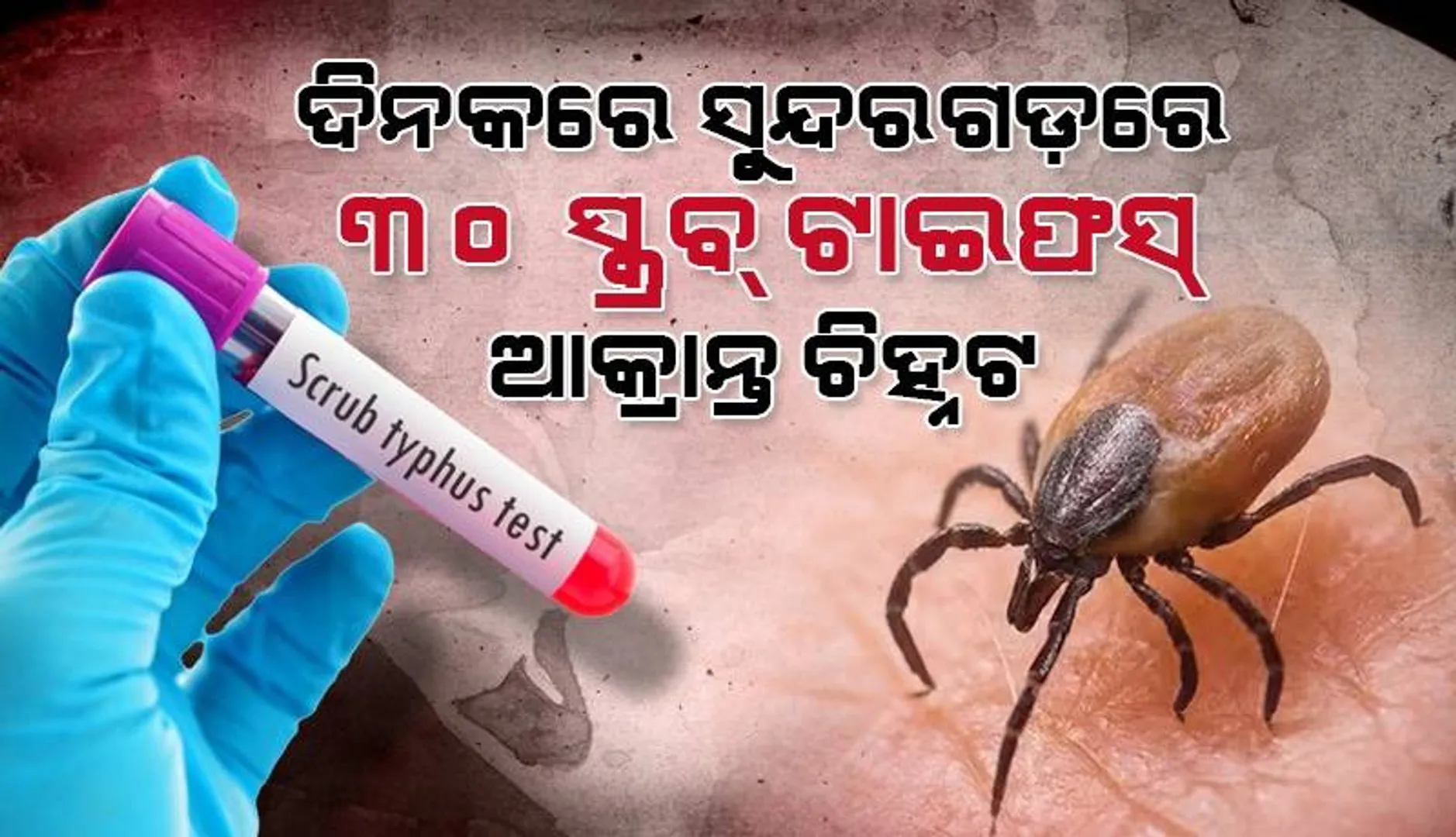 ଚିନ୍ତା ବଢାଇଲା ସ୍କ୍ରବ୍ ଟାଇଫସ୍‌: ସୁନ୍ଦରଗଡ଼ରେ ଗୋଟିଏ ଦିନରେ ୩୦ ଆକ୍ରାନ୍ତ ଚିହ୍ନଟ