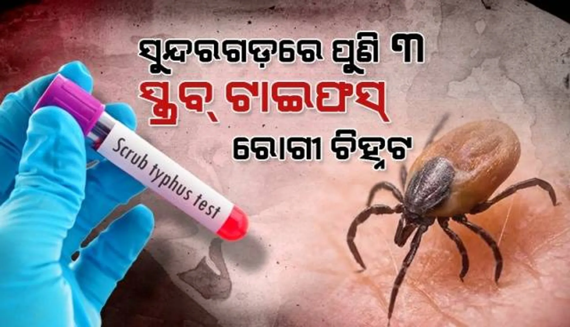 ସୁନ୍ଦରଗଡ଼ରେ ବଢୁଛି ସ୍କ୍ରବ୍ ଟାଇଫସ: ଆଜି ପୁଣି ୩ ରୋଗୀ ଚିହ୍ନଟ, ସଂଖ୍ୟା ପହଞ୍ଚିଲା ୧୮୩ରେ