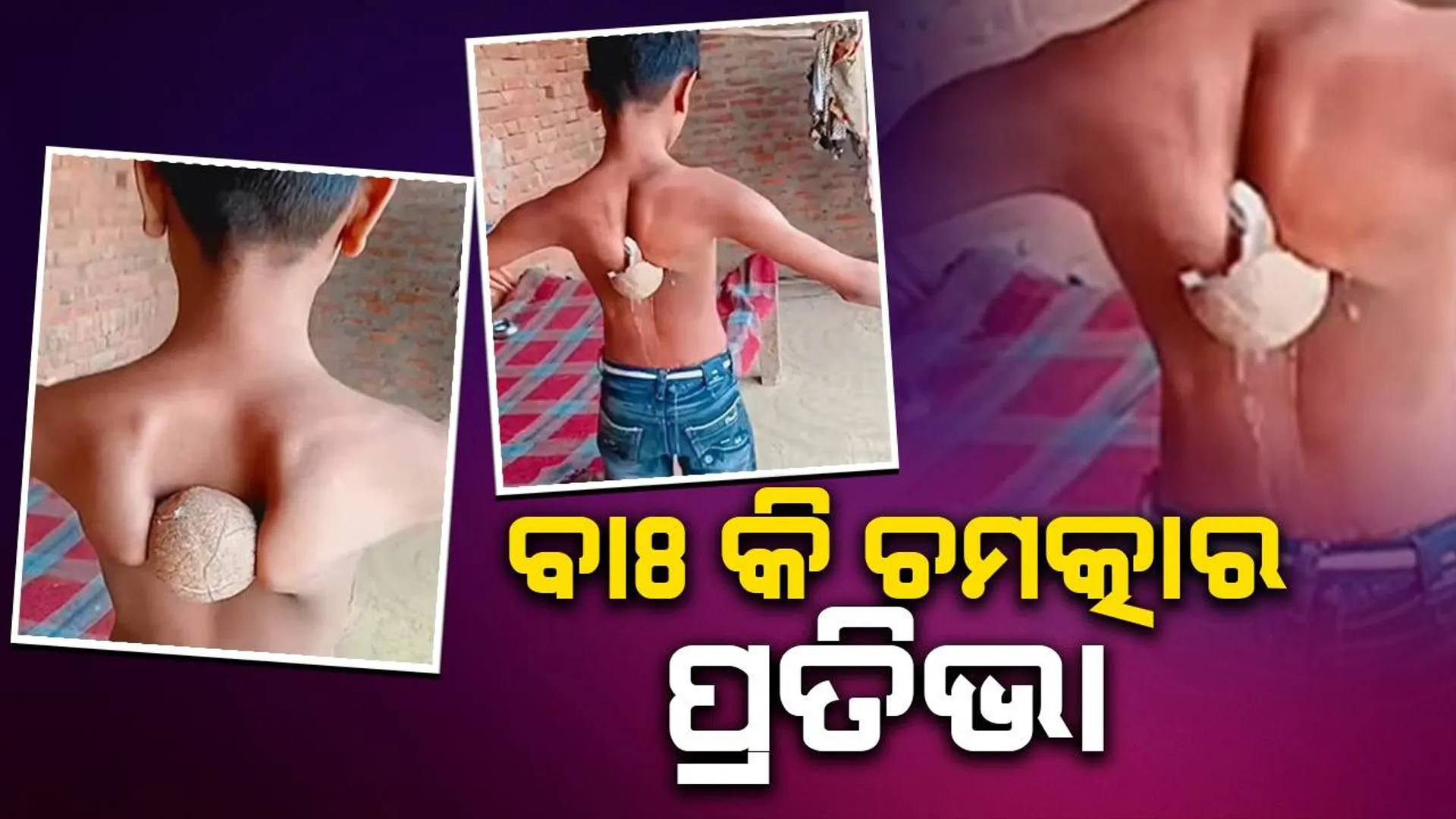 ପିଠି ହାଡ଼ରେ ନଡ଼ିଆ ଭାଙ୍ଗୁଛନ୍ତି ଶିଶୁ: ଭିଡିଓ ଭାଇରାଲ