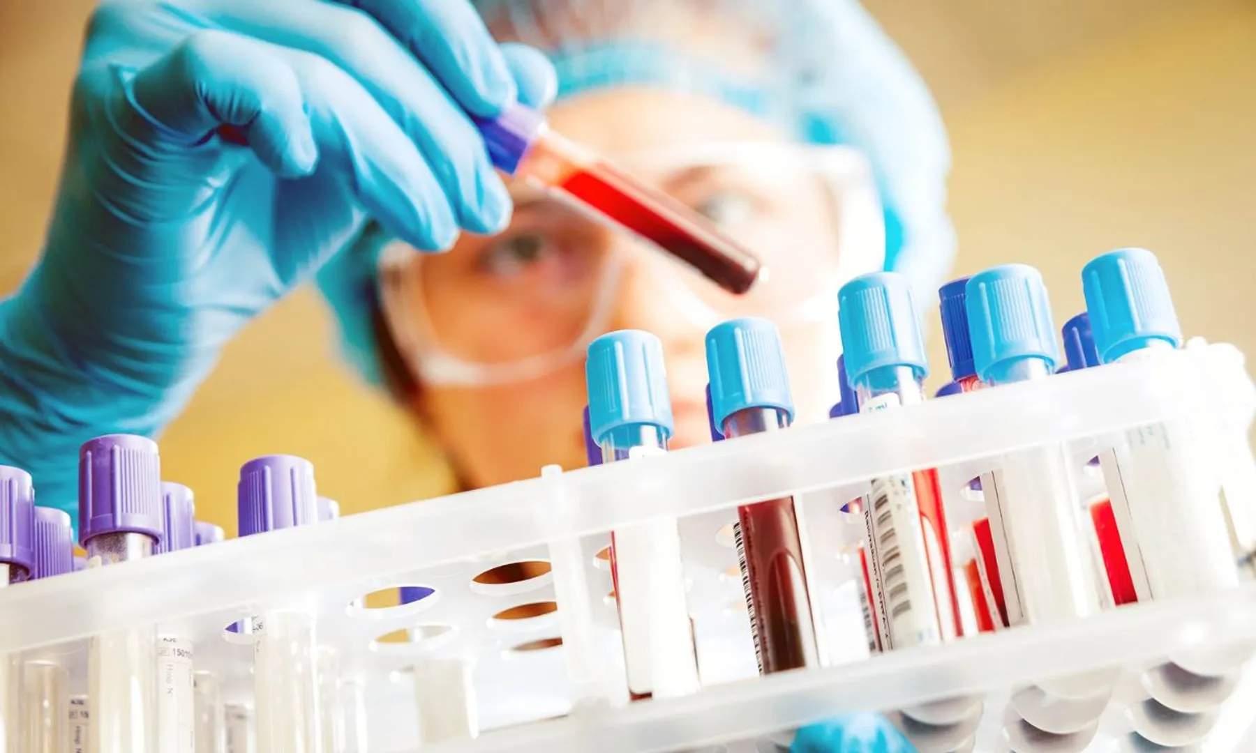 People with blood group B might age more slowly, says study