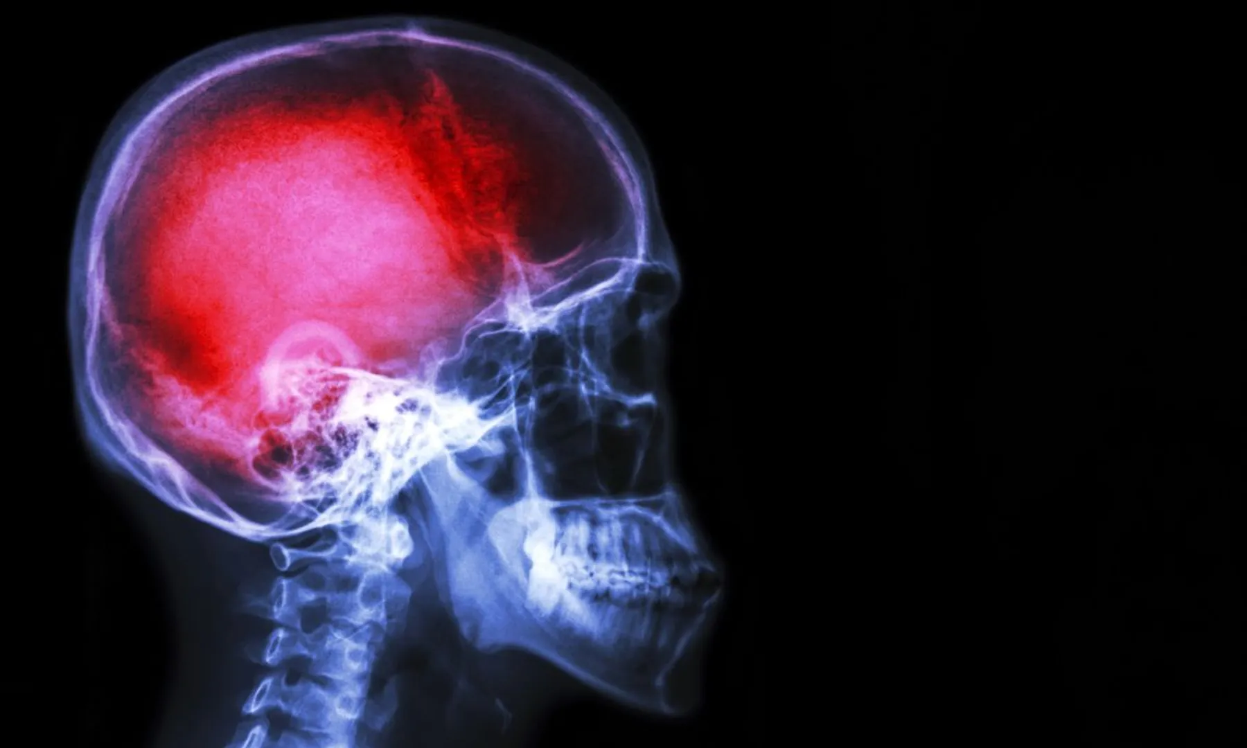 How your brain can 'turn off' pain when you need it most  Explained
