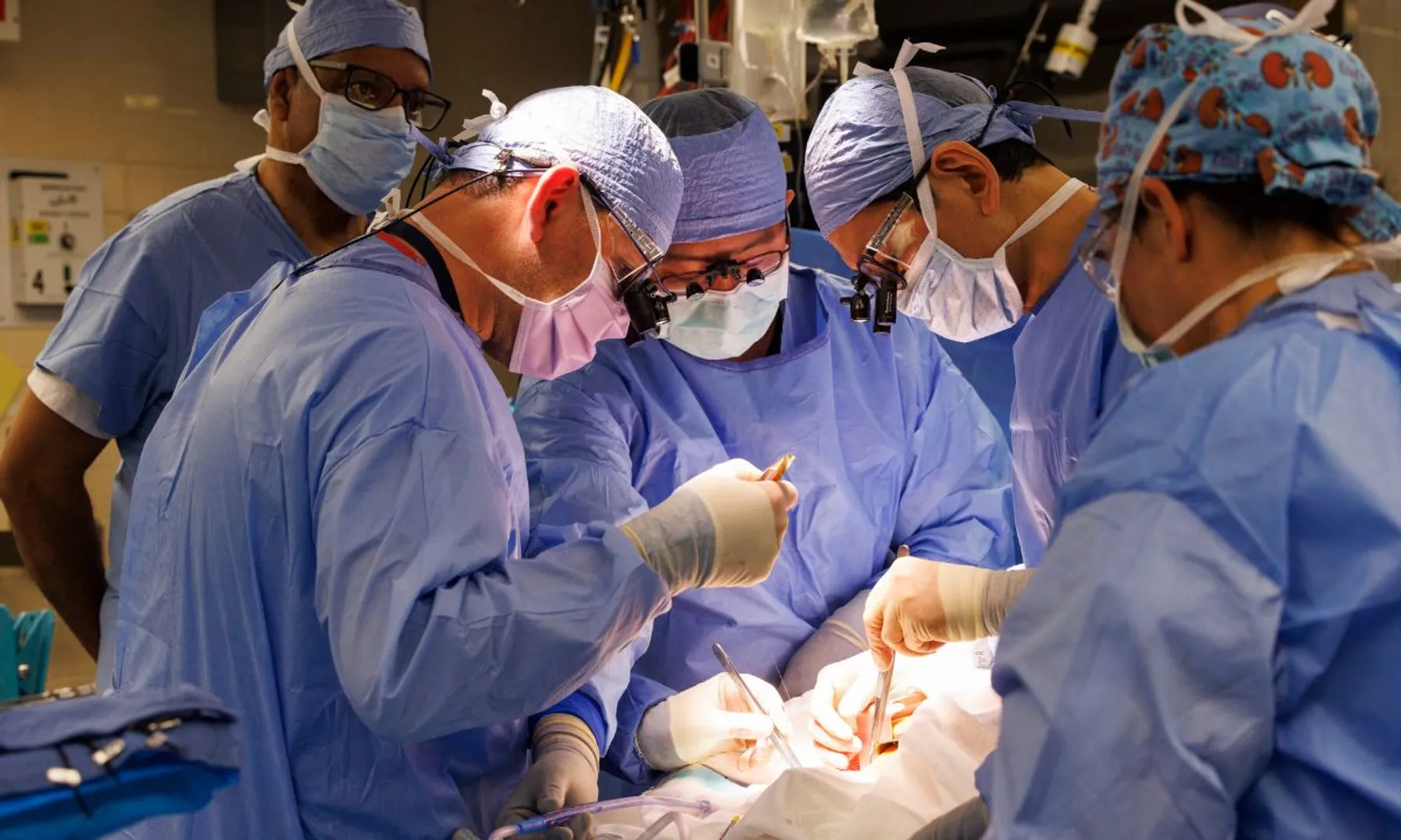 Delhi man undergoes rare kidney transplant, now has five kidneys