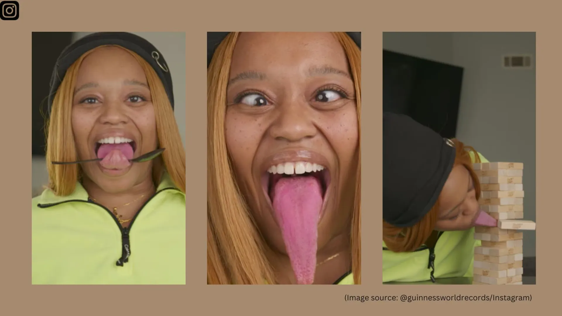 Tongue