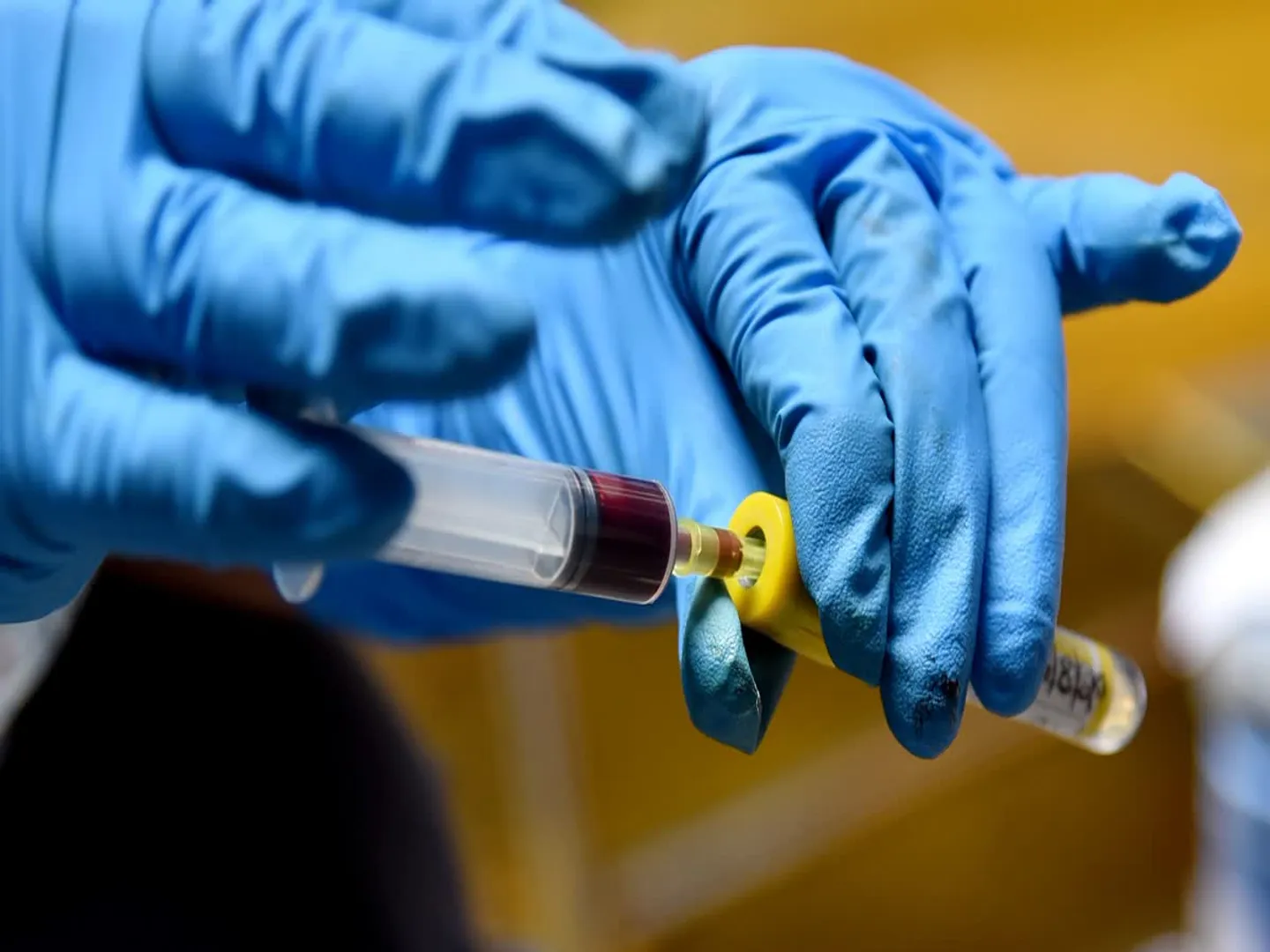 Blood test