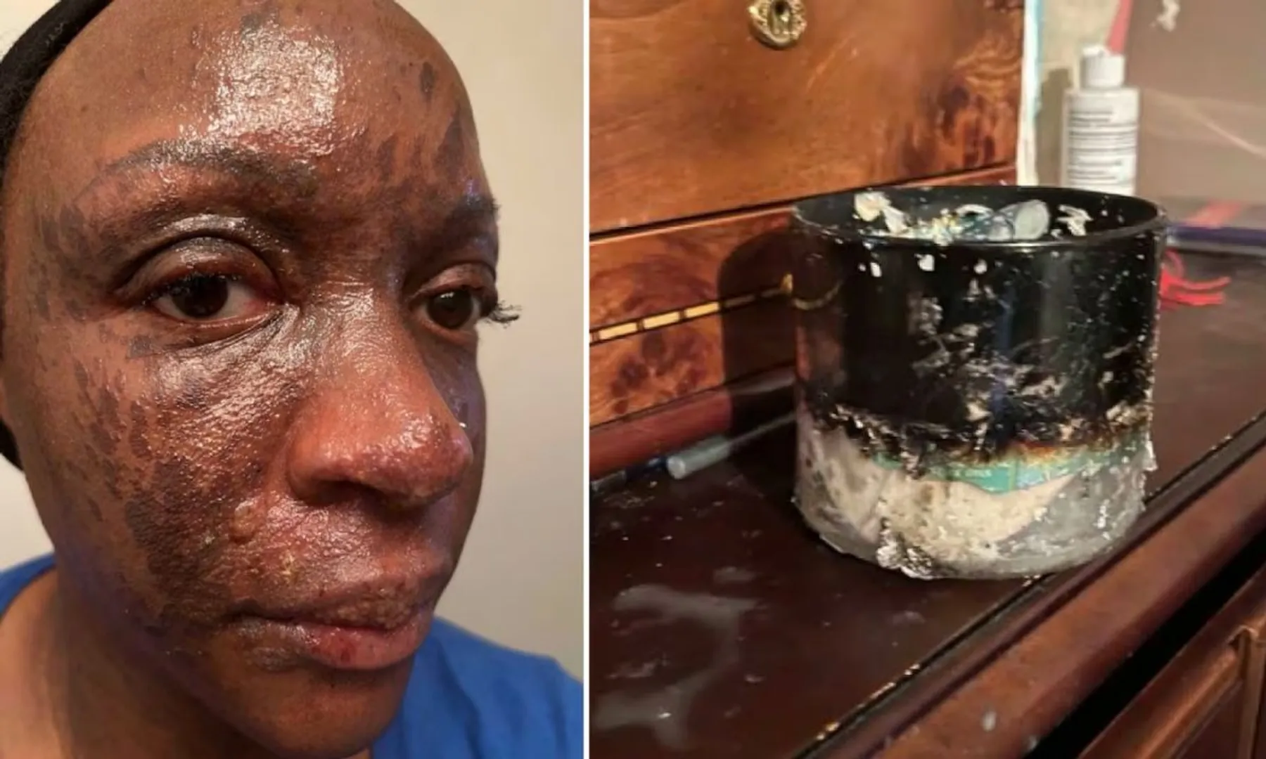 Woman sues Bath And Body Works after candle explodes in her face