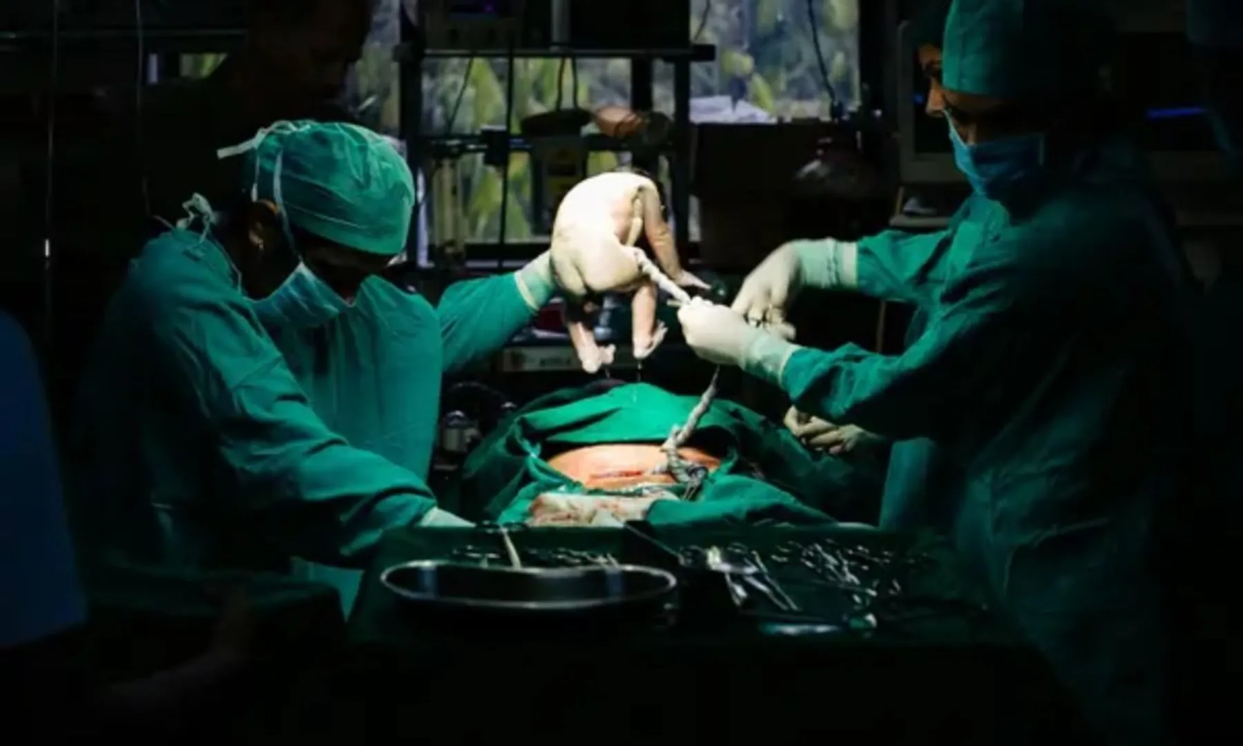 First time, doctors in China successfully implant pig lung into a human