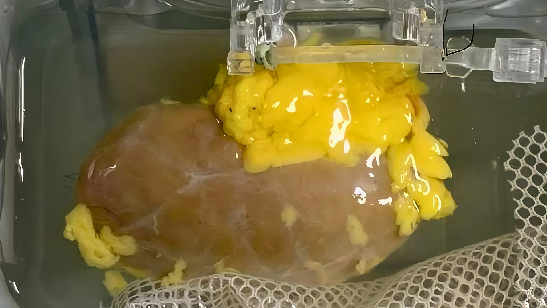  Scientists make  kidney that works with all blood types: Here’s what it means post image